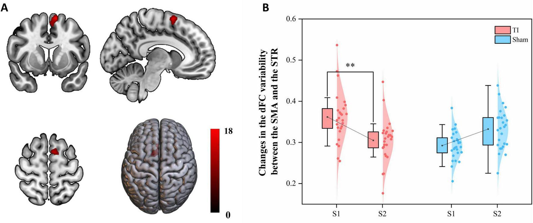 Panel A shows four brain images with highlighted red areas indicating activation, viewed from coronal, sagittal, axial, and top perspectives. Panel B presents a violin plot comparing dFC variability changes between SMA and STR in two conditions: TI and Sham, depicted for S1 and S2 sessions. The plot uses red for TI and blue for Sham, with a significant difference marked with a double asterisk between S1 and S2 in the TI condition.
