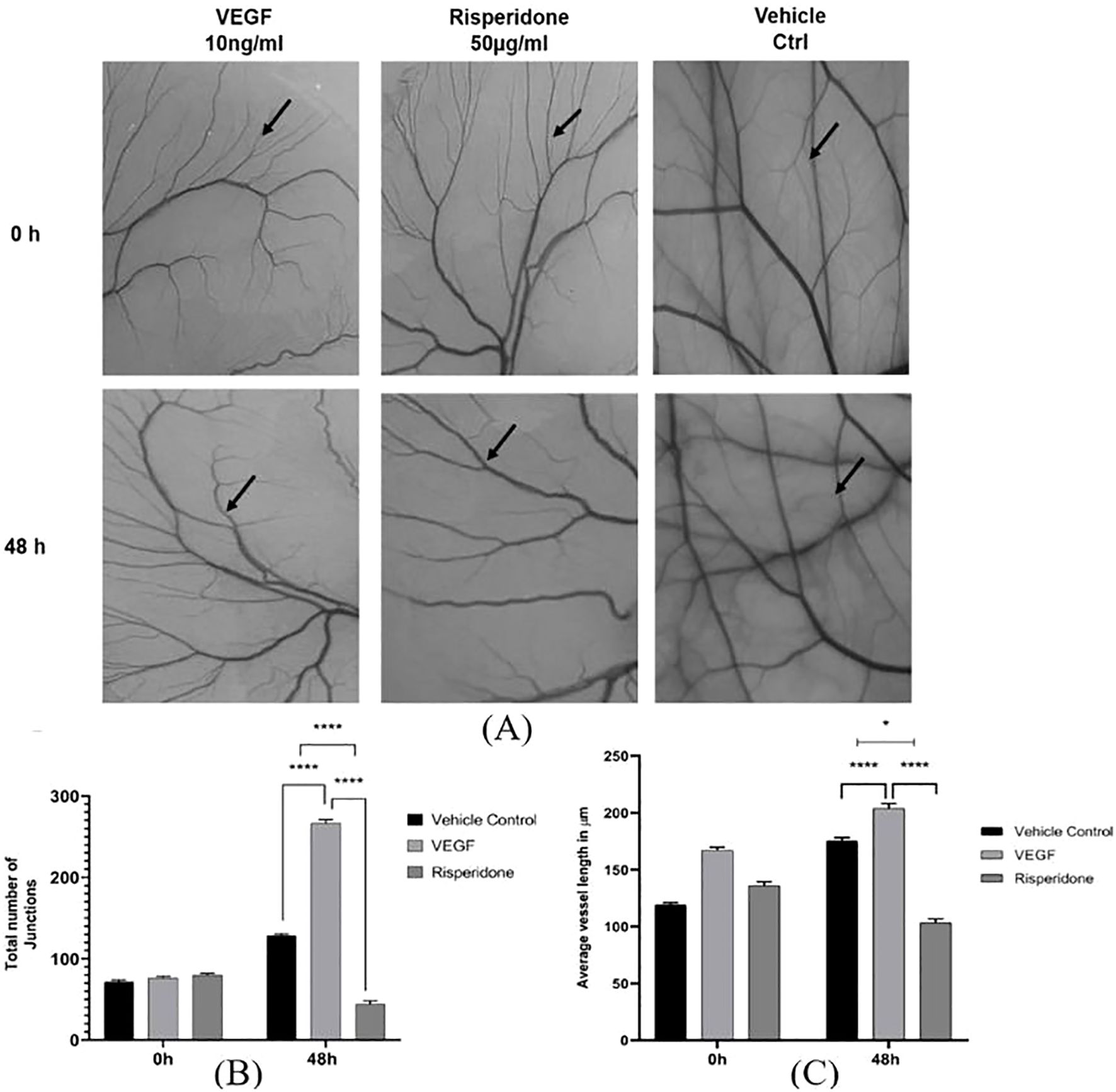 Panel A shows three sets of vascular images at 0 and 48 hours under VEGF, Risperidone, and Vehicle control conditions, each with arrows indicating vessel growth. Panel B is a bar graph displaying the total number of junctions, showing significant increases over 48 hours with VEGF. Panel C is a bar graph depicting the average vessel length in micrometers, with VEGF and Risperidone leading to longer vessels compared to the control. Statistical significance is indicated with asterisks.
