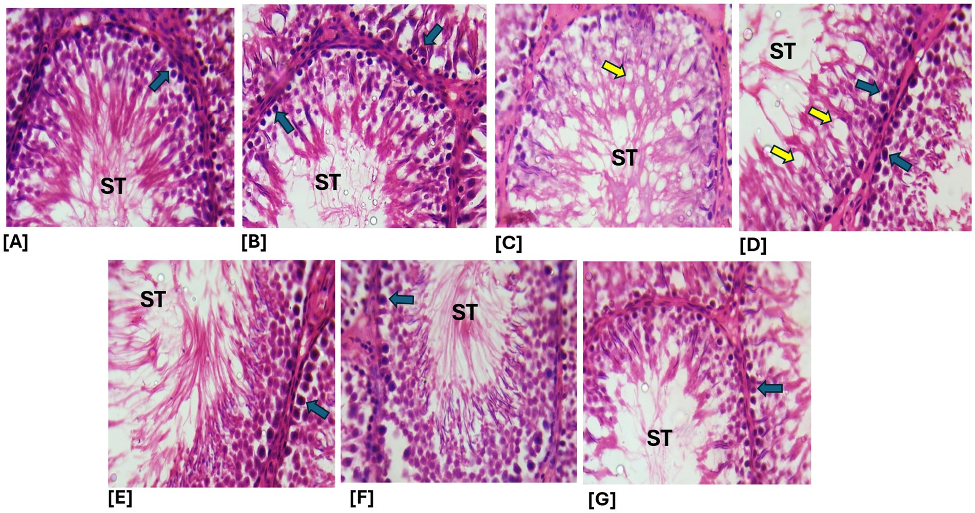 Histological images labeled A to G depict seminiferous tubules (ST) with stained cells. Blue arrows in A, B, D, E, F, and G point to specific cellular structures, while yellow arrows in C and D highlight different features. The staining reveals cellular details within the tubules.