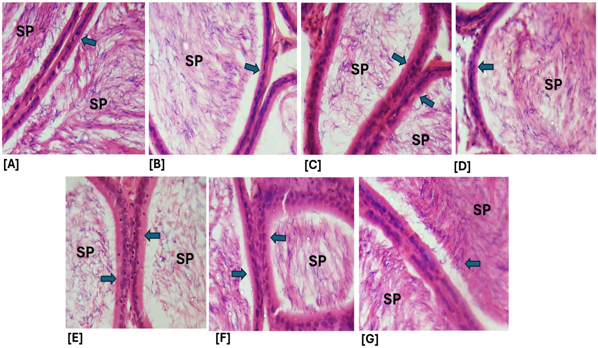 Histological images of tissue sections labeled A to G. Each section shows labeled