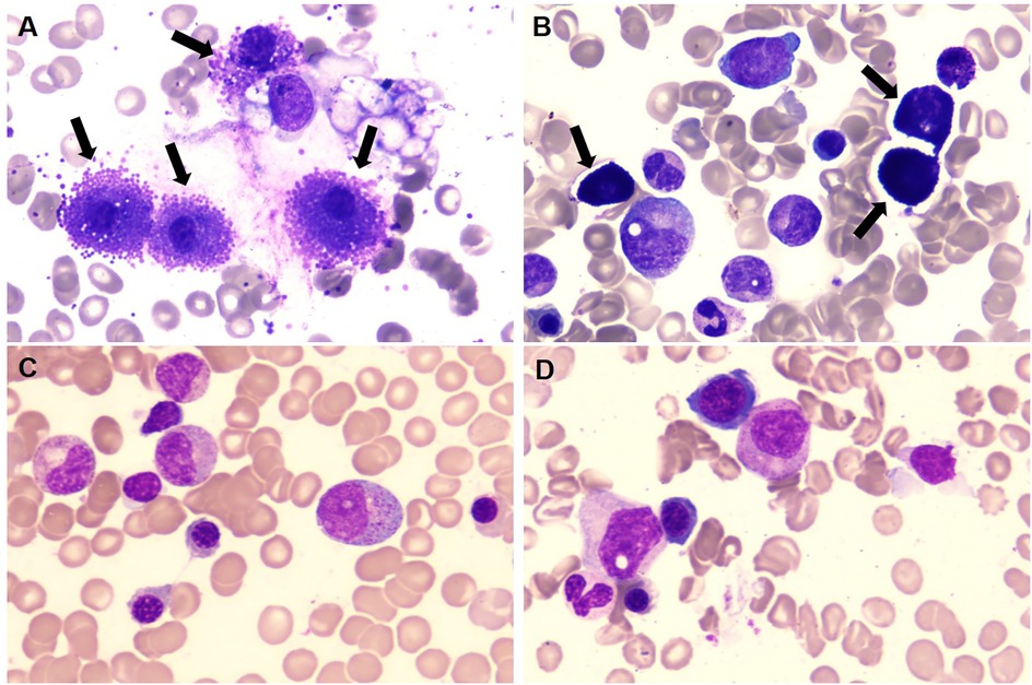 Panel A shows large, dark-stained cells with arrows indicating specific areas. Panel B features similar cells with distinct nuclei, also highlighted by arrows. Panels C and D display cells of varying sizes and staining intensities, with prominent violet nuclei in a light pink background.