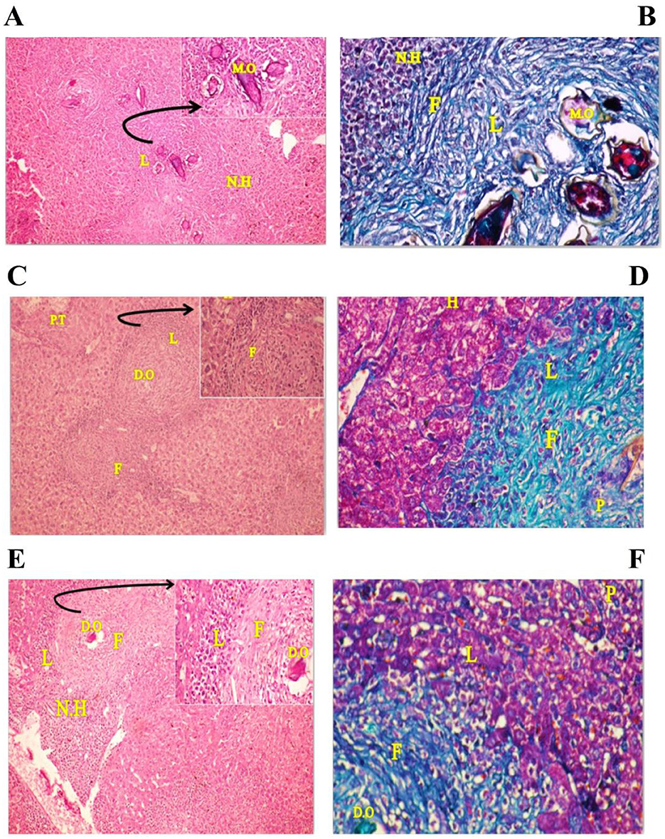 Image set of six histological slides labeled A to F. Slides A, C, and E show pink-stained liver tissues with labels like “L,” “NH,” “MO,” and “DO,” indicating different structures. Insets highlight specific features. Slides B, D, and F show blue and pink-stained sections, emphasizing fibrous tissue and other elements labeled “F,” “L,” and “P.” Each slide focuses on variations in liver morphology and connective tissue.