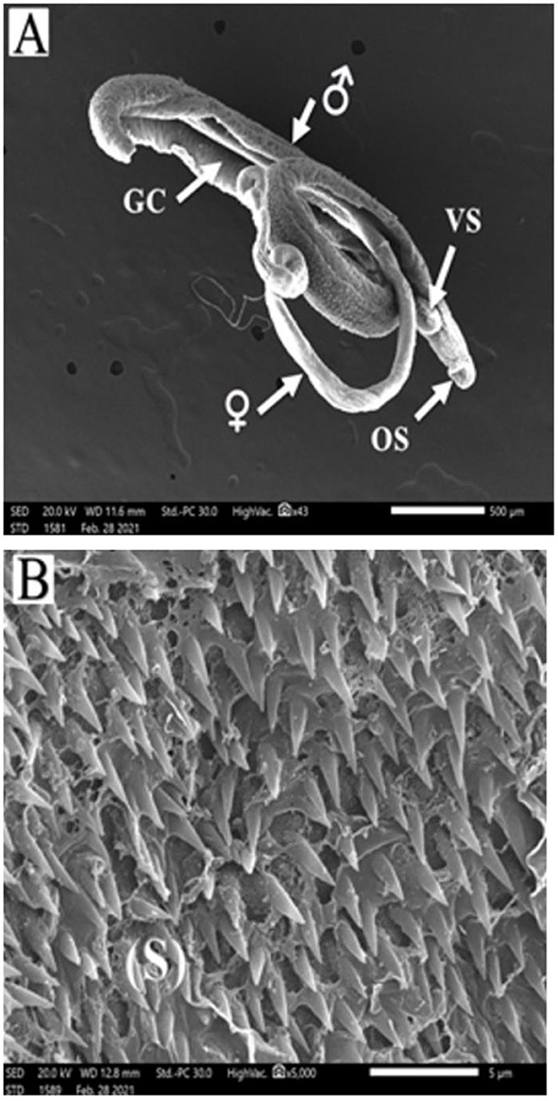 Panel A shows a scanning electron microscope image of a parasite labeled with arrows for GC, male, female, VS, and OS parts. Panel B features a close-up of a textured surface with sharp, scale-like structures marked with an S.