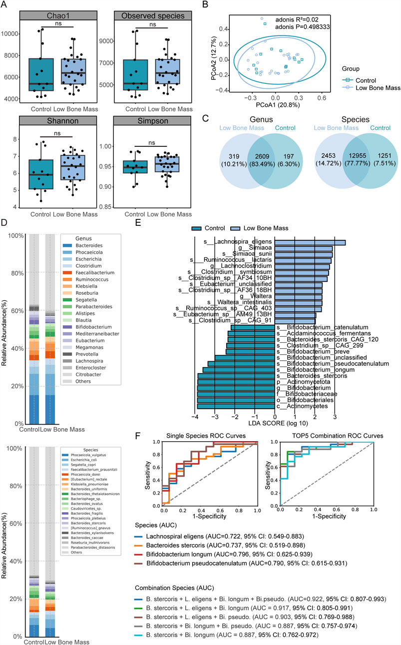 A multi-panel scientific figure illustrates various analyses related to bone mass and metabolites. Panel A presents a principal component analysis differentiating control and low bone mass groups, accompanied by a correlation plot. Panel B features a volcano plot of differential secondary metabolites between control and low bone mass, with changes highlighted. Panel C highlights the count of metabolite superclasses. Panel D is a bar chart of key KEGG pathway categories, differentiated by color. Panel E shows an enriched pathway bubble plot. Panel F is a heatmap showing bacteria-metabolite correlations. Panel G illustrates a network of microbe-metabolite correlations. Panel H categorizes significant metabolites in a bar chart based on pathway levels.