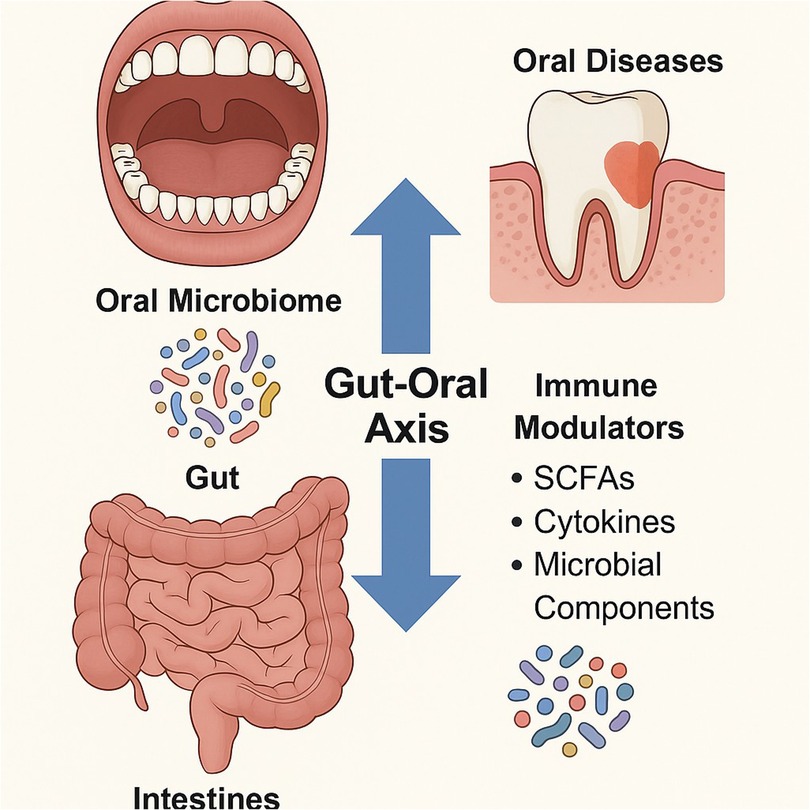 Diagram illustrating the gut-oral axis, showing interactions between the gut and oral microbiomes through immune modulators such as short-chain fatty acids, cytokines, and microbial components, influencing oral health and disease.