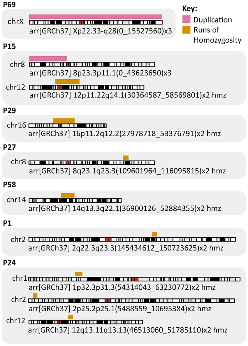 Diagram displaying genomic segment data for seven patients labeled P69, P15, P29, P27, P58, P1, and P24. Each patient has chromosome regions annotated with duplications in pink and runs of homozygosity in orange. The patients' chromosomal alterations are detailed with genomic coordinates and copy number changes, aligned with the GRCh37 (hg19) reference genome.