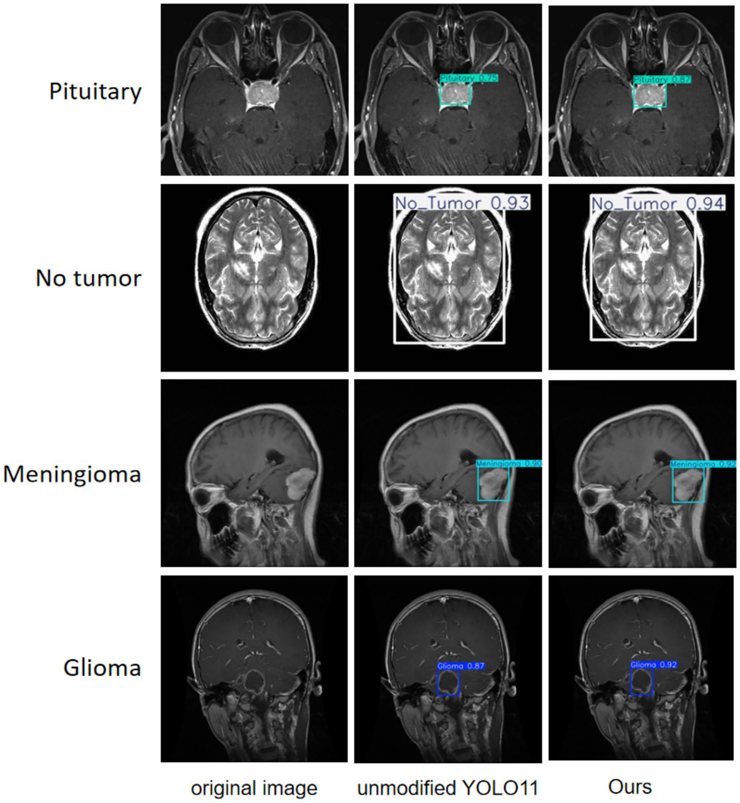 MRI scans showing four brain conditions: pituitary, no tumor, meningioma, and glioma. Each condition has three images: the original, results from YOLO11, and the study's method. Tumors are marked with probabilities.