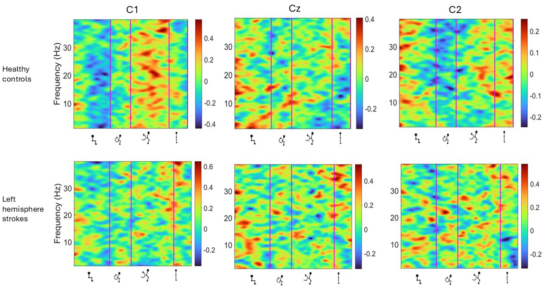 Six heat maps compare frequency (Hertz) and wave forms across two groups: healthy controls and left hemisphere stroke patients. The columns, labeled C1, Cz, and C2, show variations in color intensity, indicating differences in brain activity patterns.