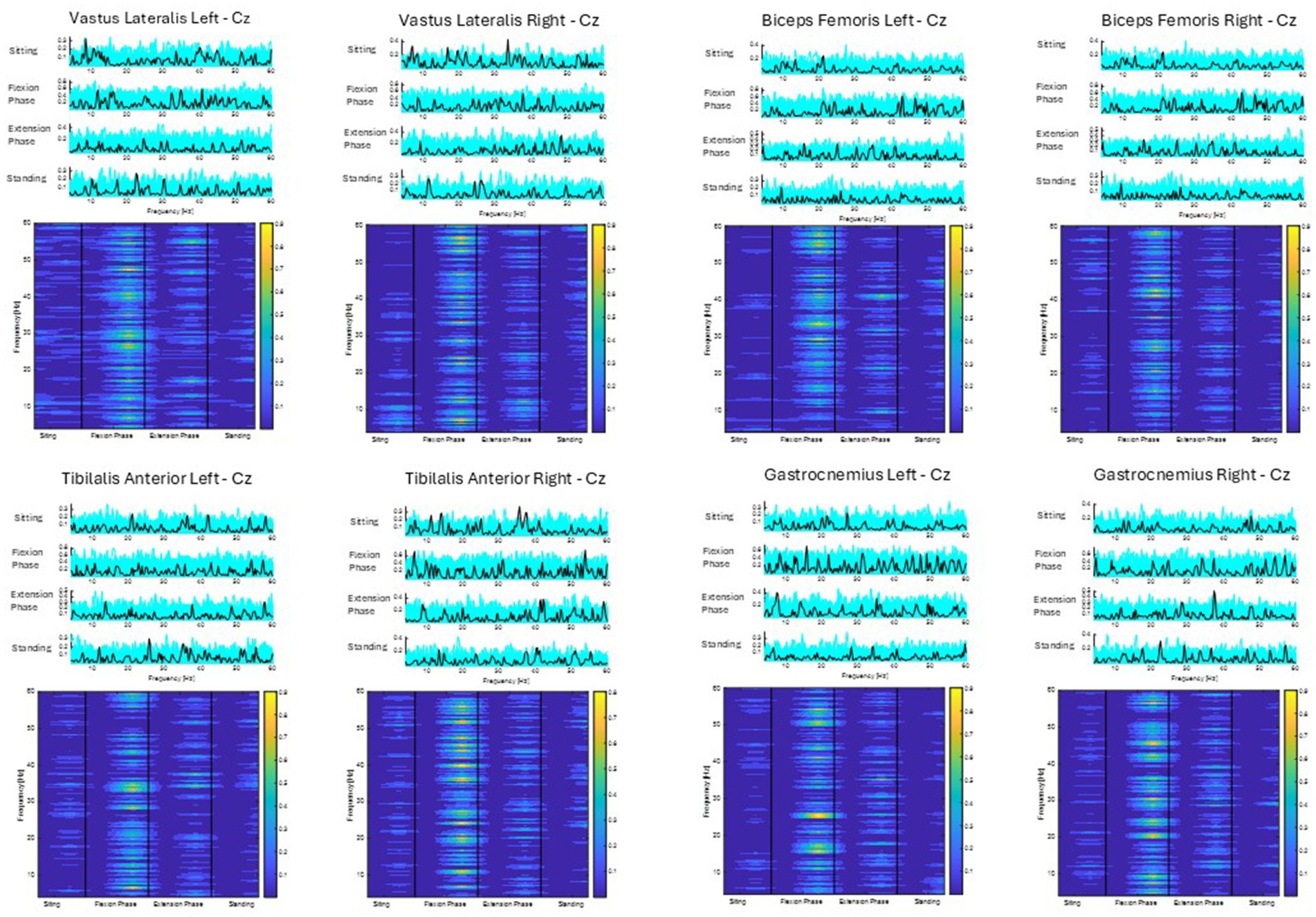 Corticomuscular coherence data for coherence between each muscle (Vastus Lateralis, Biceps Femoris, Tibialis Anterior, and Gastrocnemius) and the Cz electrode. The data shows coherence during sitting, flexion, extension, and standing phases. The upper plots show coherence across the frequency domain (black line), alongside 75 randomly generated surrogate coherence spectra (turquoise line). The lower plots show the colour coded magnitude of coherence as indicated using colour bars to the right of the plots.