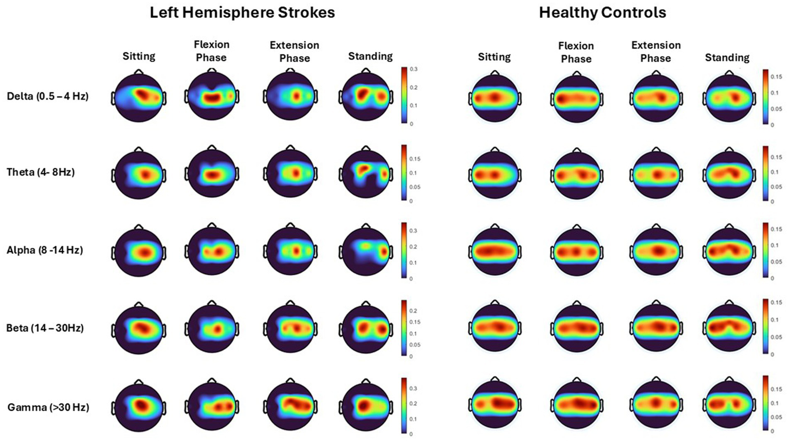 Topographical heat maps compare brain activity in different frequency bands during various movements between individuals with left hemisphere strokes and healthy controls. Columns represent sitting, flexion, extension, and standing phases, while rows show delta, theta, alpha, beta, and gamma bands. Intensity is indicated by color, with scales provided for each condition.