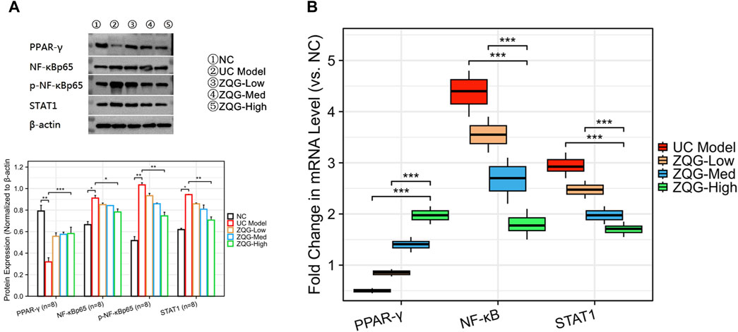 Panel A shows a Western blot and bar graph depicting protein expression for PPAR-γ, NF-κB p65, phosphorylated NF-κB p65, STAT1, and β-actin, adjusted to β-actin. Samples are from NC, UC Model, and ZQG treatments at low, medium, and high concentrations. Significant differences are indicated with asterisks. Panel B is a box plot displaying fold changes in mRNA levels for PPAR-γ, NF-κB, and STAT1 across the same groups. Statistical significance is denoted by asterisks.