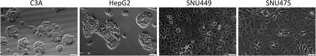 Microscopic images of four cell lines labeled as C3A, HepG2, SNU449, and SNU475. C3A and HepG2 show clusters of rounded cells, while SNU449 and SNU475 display more irregular and interconnected cell patterns. Each image includes a scale bar for reference.