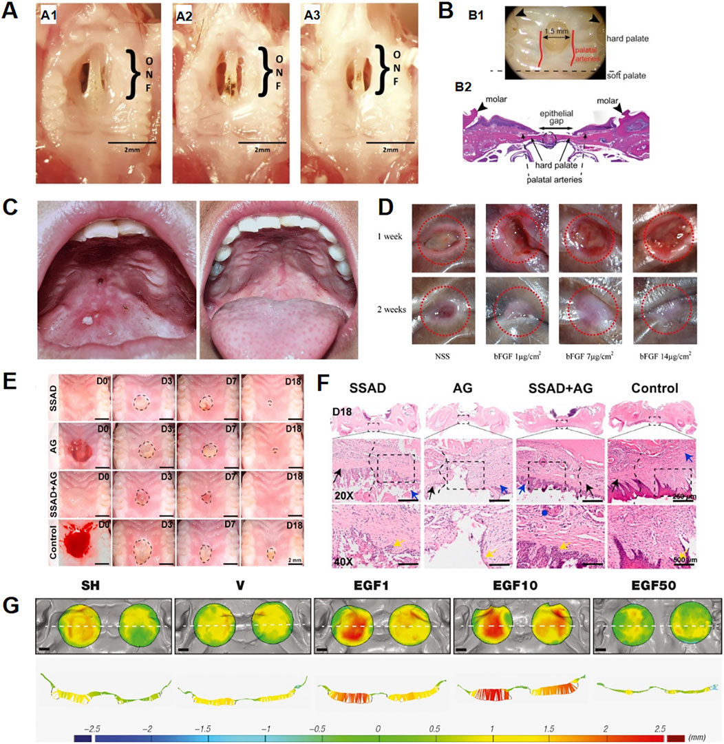A series of scientific images depicting various stages of oral cavity studies. Images A1 to A3 show the open nasal floor (O) and nasal septum (N) with the area of focus (F). Image B includes a diagram of palatal structures and a sectional view with labeled anatomy. Image C shows two views of the inside of a mouth. Image D illustrates comparative healing of wounds at one and two weeks using different treatments. Image E displays wound healing progression over 18 days under different treatments, compared to a control. Image F shows histological sections from day 18, examining tissue structure under different conditions. Image G presents topographical data visualizations of surfaces under varying conditions, highlighting differences in measurements. Scale bars indicate size reference.