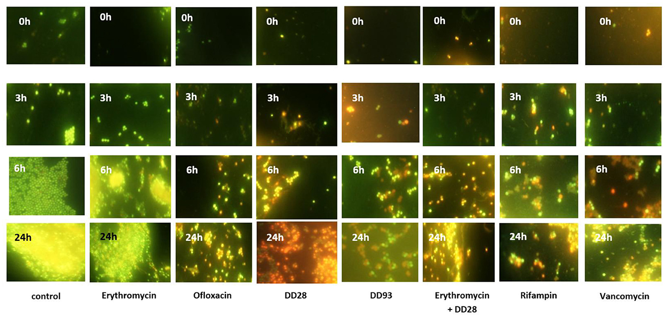 A series of fluorescent microscopy images showing bacterial growth over time with different treatments. The grid shows images at 0, 3, 6, and 24 hours for each treatment: control, erythromycin, ofloxacin, DD28, DD93, erythromycin with DD28, rifampin, and vancomycin. Each row represents a different time point, displaying variations in bacterial growth and fluorescence intensity.