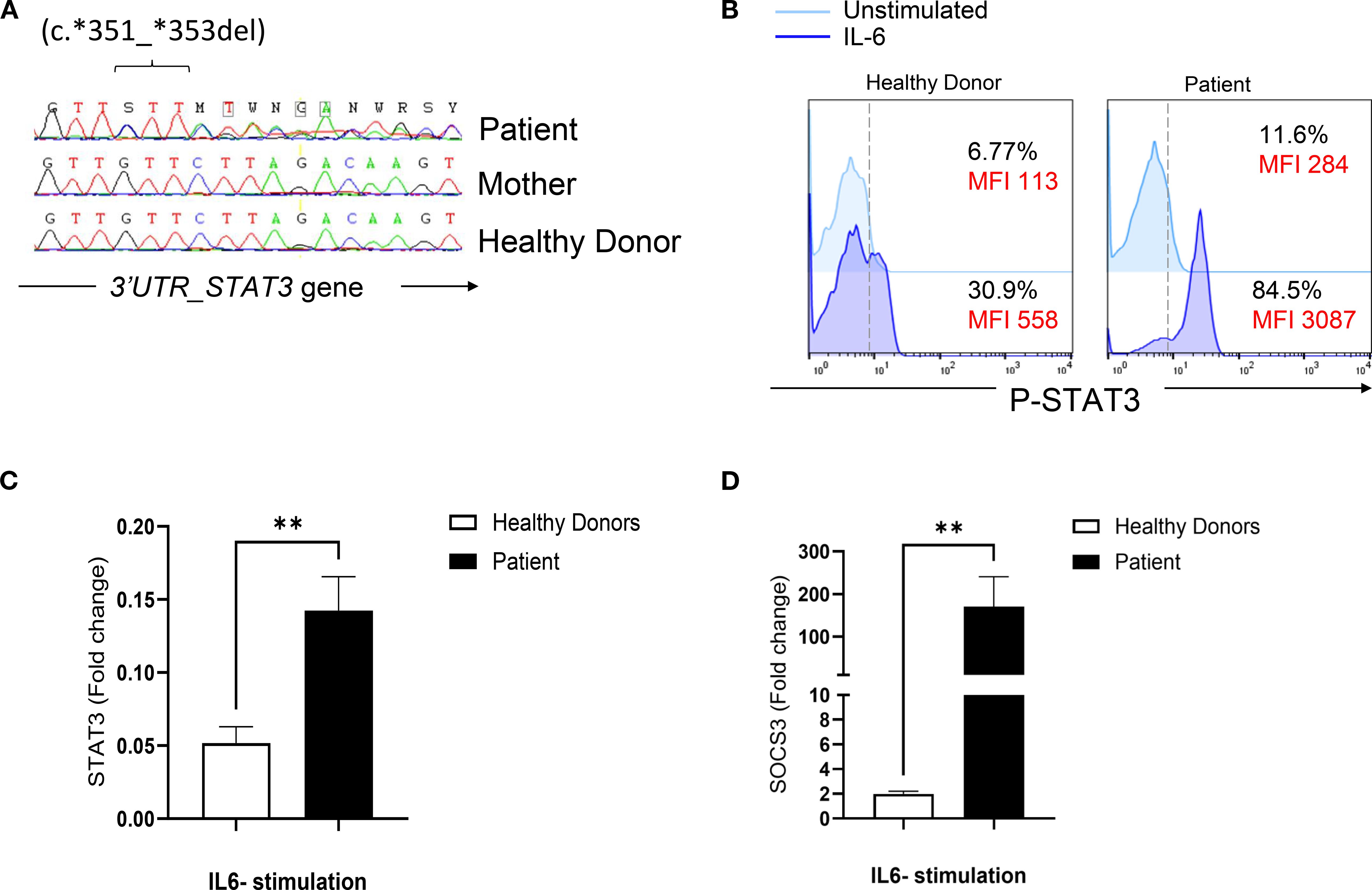 Panel A shows a genetic sequence with a deletion (c.*351_*353del) in the 3'UTR of the STAT3 gene in a HIES suspected patient. Panel B displays flow cytometry graphs of P-STAT3 expression comparing unstimulated and IL-6 stimulated conditions in a healthy donor and the patient, highlighting differences in mean fluorescence intensity (MFI). Panel C is a bar chart showing the fold change of STAT3 upon IL-6 stimulation between healthy donors and the patient, with patient showing a significant increase. Panel D is a bar chart comparing the fold change of SOCS3, showing a higher increase in the patient compared to healthy donors with IL-6 stimulation.
