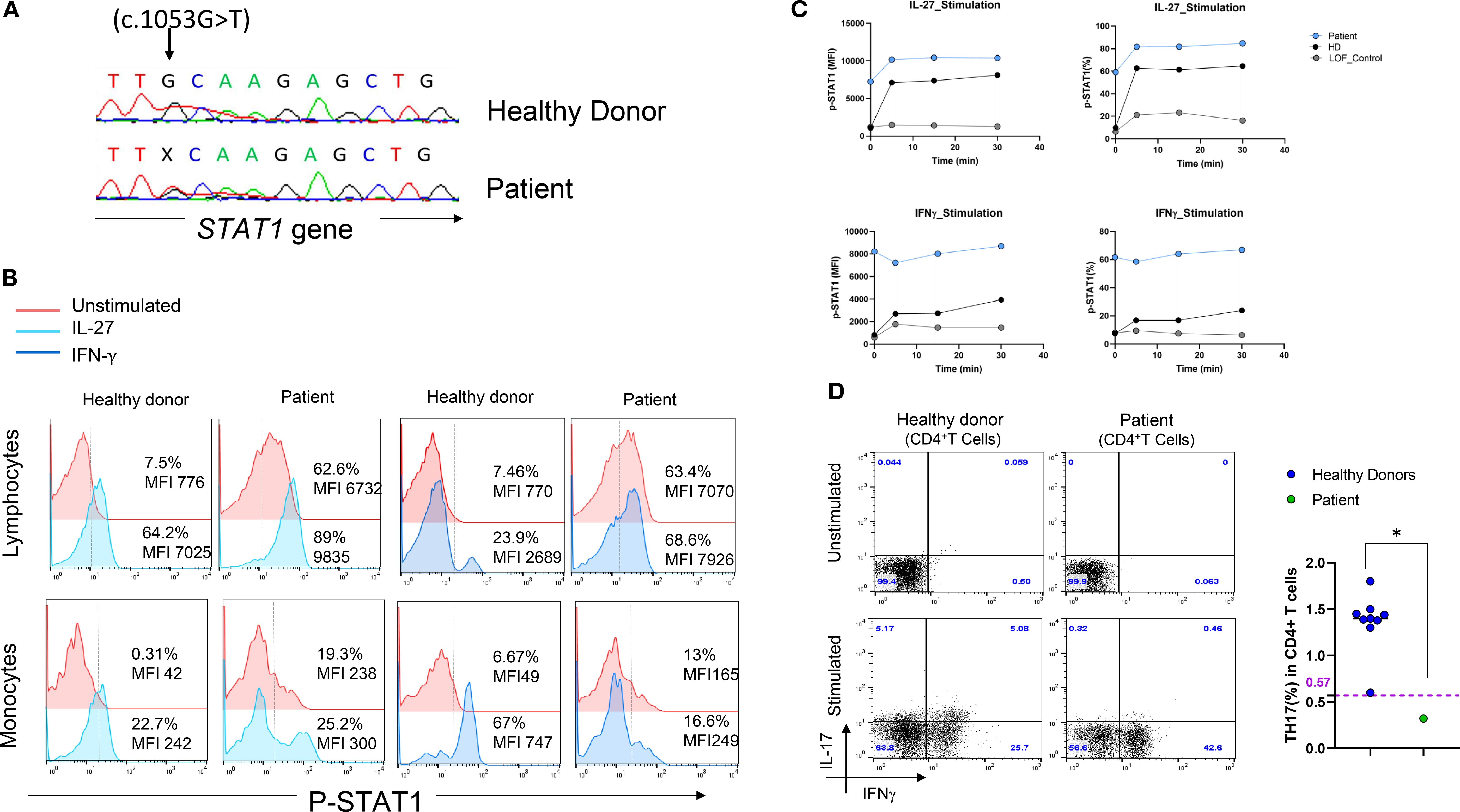 Panel A shows a gene sequence comparison highlighting a c.1053G>T mutation in the STAT1 gene In a HIES suspected patient. Panel B presents flow cytometry histograms comparing lymphocyte and monocyte responses to IL-27 and IFN-γ in a healthy donor and the patient. Panel C displays line graphs of p-STAT1 levels over time with IL-27 and IFN-γ stimulation in the patient and controls. Panel D illustrates flow cytometry dot plots analyzing IL-17 and IFN-γ production in CD4+ T cells from a healthy donor and the patient, with a bar graph quantifying TH17% in CD4+ T cells, indicating a significant difference.