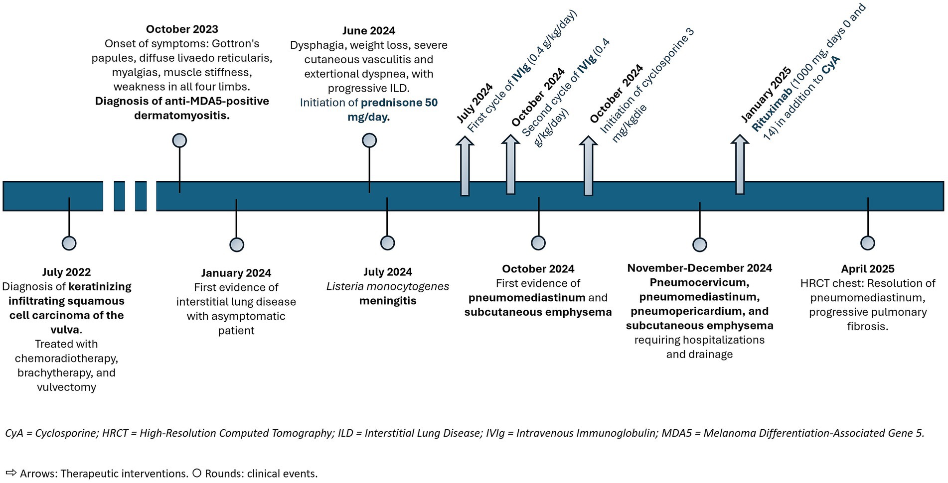 Timeline illustrating a patient's medical events from July 2022 to April 2025. Key events include the diagnosis of keratinizing infiltrating squamous cell carcinoma of the vulva in July 2022, the onset of anti-MDA5-positive dermatomyositis in October 2023, and various treatments and complications such as IVIg cycles, prednisone, and Rituximab. The graph shows clinical events as circles and therapeutic interventions with arrows. The patient's condition progresses through multiple health challenges, including interstitial lung disease and pneumomediastinum, with partial resolution by April 2025.