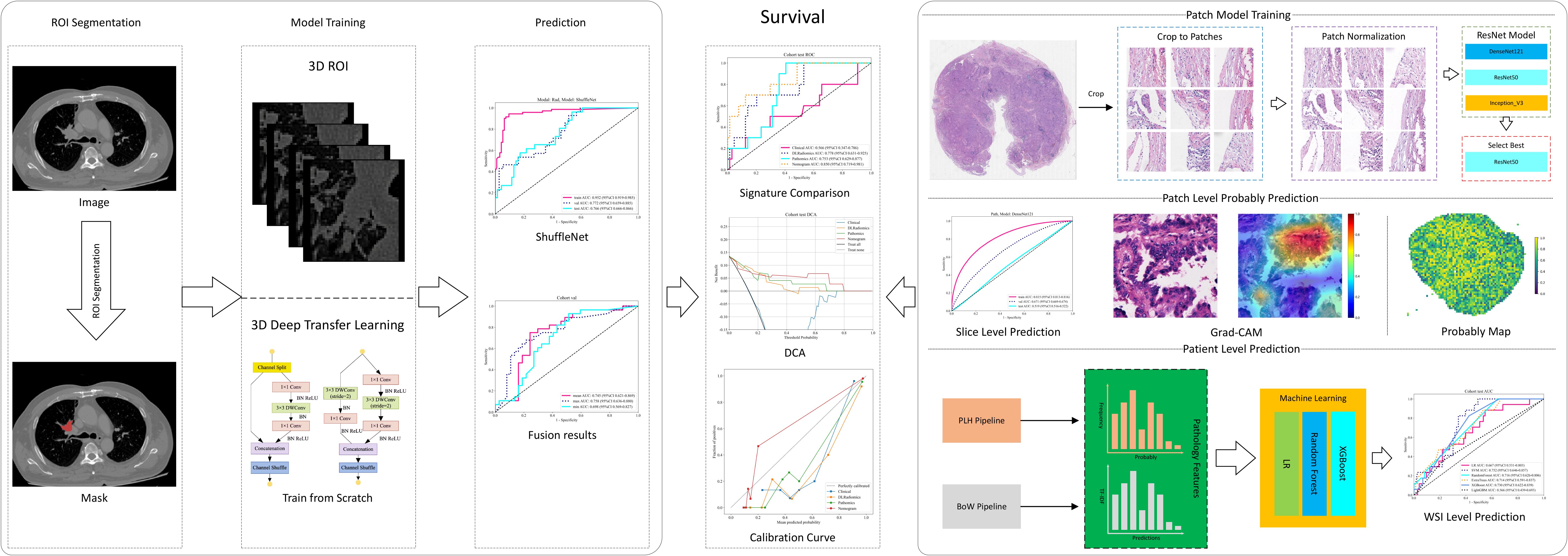 Workflow diagram illustrating a medical image analysis process. It includes three main sections: ROI Segmentation, Model Training, and Survival. In ROI Segmentation, CT images are processed into a mask. Model Training shows 3D ROI and deep transfer learning, with performance graphs like ROC and calibration curves. The Survival section details patch model training with histopathology images, algorithm selection, and predictions using Grad-CAM and probability maps. Patient and WSI level predictions are included, utilizing machine learning methods like random forest and XGBoost, with associated performance plots.