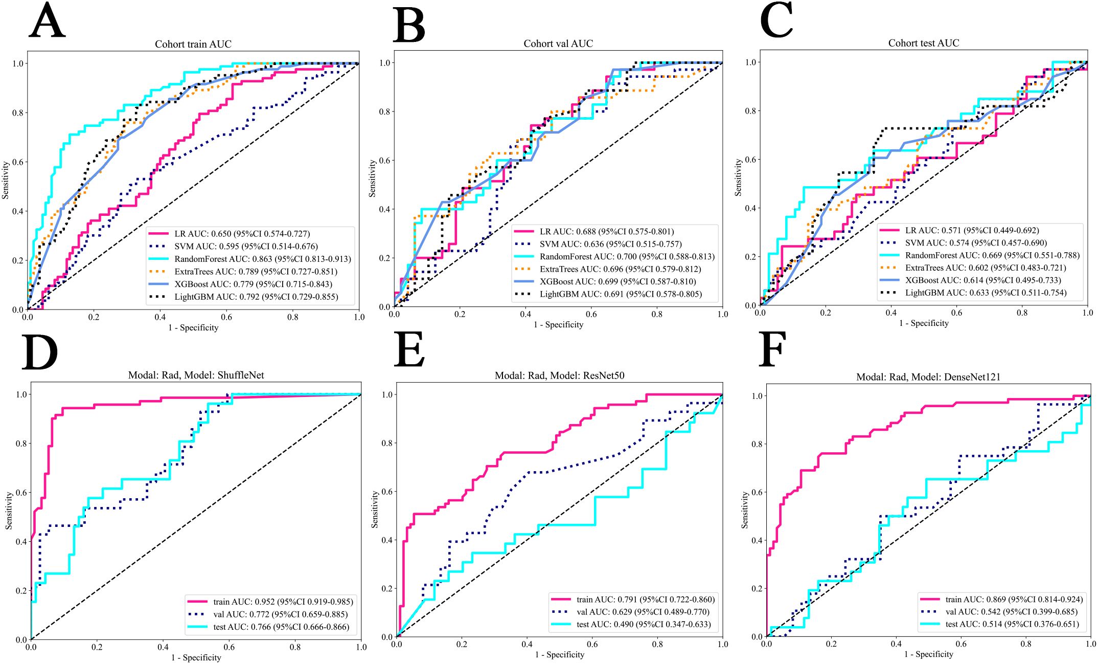 Six ROC curve graphs labeled A to F display sensitivity against 1-specificity for various models. Each graph shows performance metrics like AUC and confidence intervals for logistic regression, SVM, RandomForest, ExtraTrees, XGBoost, and LightGBM in different scenarios (train, validation, test). Graphs D, E, and F focus on specific models: ShuffleNet, ResNet50, and DenseNet121, showing different performance results for train, validation, and test sets. The curves demonstrate model performance with respect to sensitivity and specificity.