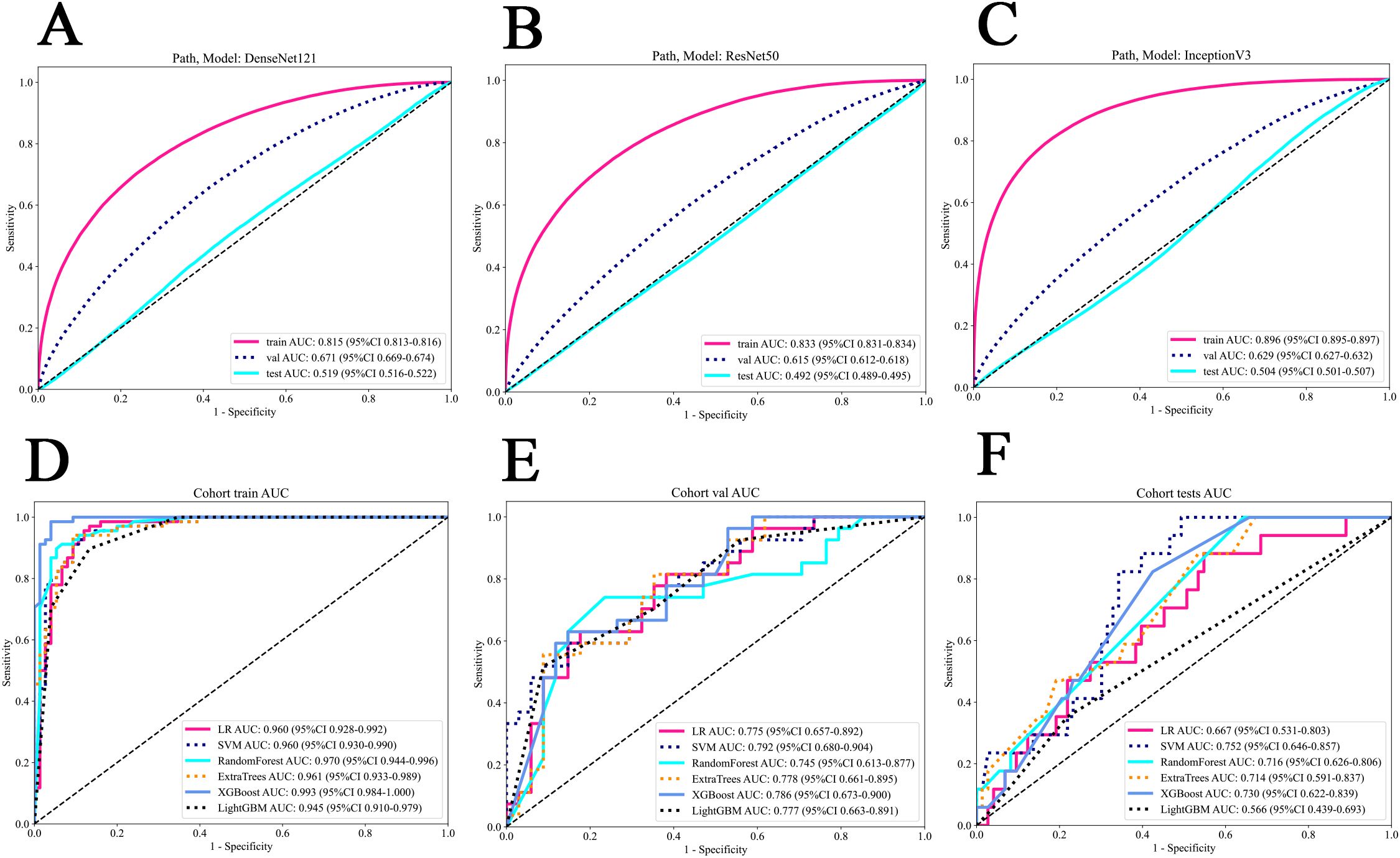 Panels A to C show ROC curves for models DenseNet121, ResNet50, and InceptionV3 with training (AUC 0.815-0.896), validation (AUC 0.615-0.671), and test results (AUC 0.492-0.519). Panels D to F display ROC curves for various models in cohort training, validation, and testing datasets, with AUCs ranging from 0.667 to 0.993.