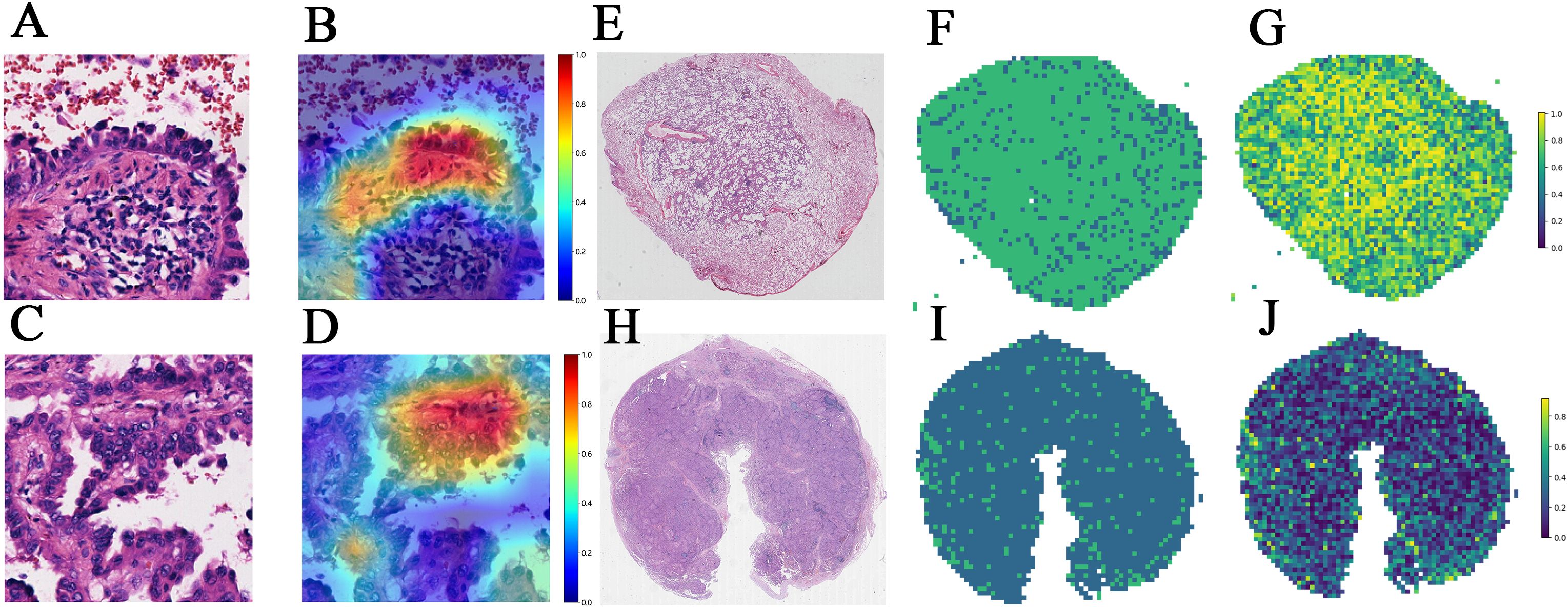 A series of images labeled A to J. A and C show histological slides with cellular details stained in pink and purple. B and D are heatmaps corresponding to A and C with a red to blue scale. E and H display large tissue sections stained in pink and purple. F and I are pixelated graphics in shades of green and blue. G and J are pixelated heatmaps with color ranging from yellow to blue. The images visually represent histological and heatmap analyses.