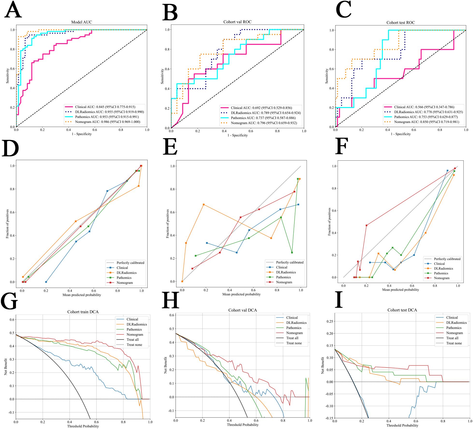 Panels A to C show ROC curves for model performance with clinical, DL radiomics, radiomics, and nomogram approaches. Panels D to F present calibration plots illustrating predicted versus actual probabilities. Panels G to I display decision curve analyses (DCA) for the training, validation, and test cohorts, assessing net benefit across threshold probabilities.