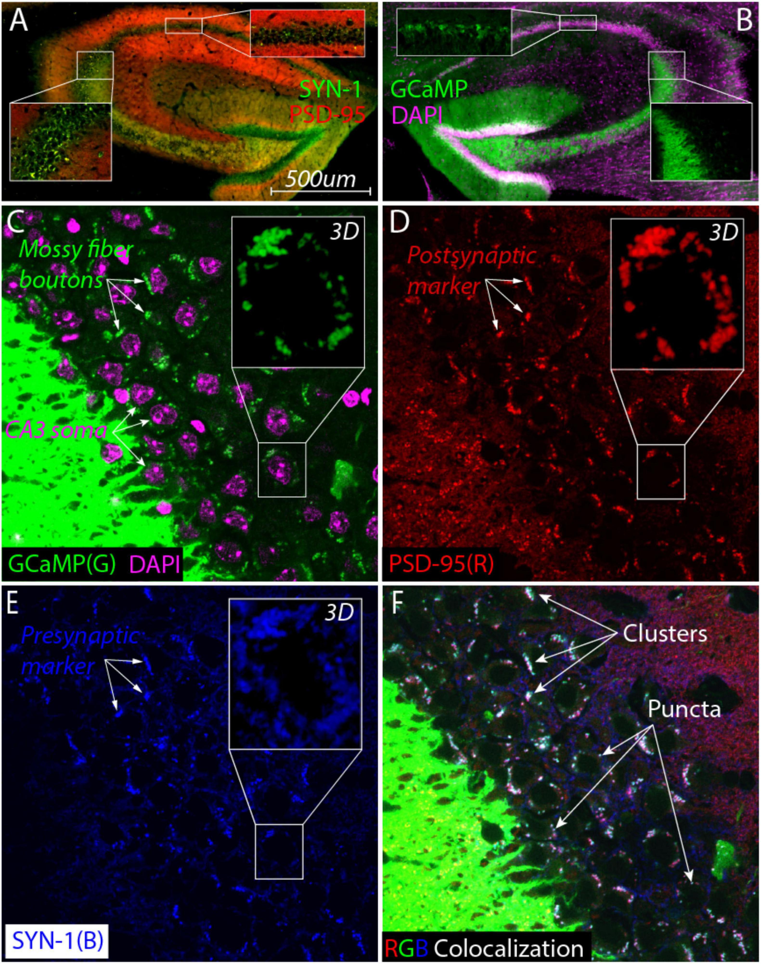 A composite image showing fluorescent microscopy of brain tissue. Panel A shows green and red labeling for SYN-1 and PSD-95 with scale. Panel B displays GCaMP and DAPI staining. Panel C highlights mossy fiber boutons and CA3 soma labeled in green and purple. Panel D demonstrates postsynaptic markers using red fluorescence. Panel E illustrates presynaptic markers with blue labeling. Panel F combines RGB colors to show colocalization, indicating clusters and puncta. Each panel includes 3D insets for detailed views.