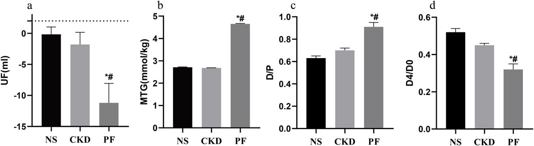 Bar graphs labeled a, b, c, and d compare three groups: NS, CKD, and PF. Graph a shows UF (milliliters), with NS and CKD around zero, PF significantly lower. Graph b presents MTG (millimoles per kilogram), with PF notably higher. Graph c depicts D/P ratios, with PF highest. Graph d shows D4/D0 ratios, with PF lowest. Asterisks and hash symbols indicate statistical significance in PF compared to other groups.