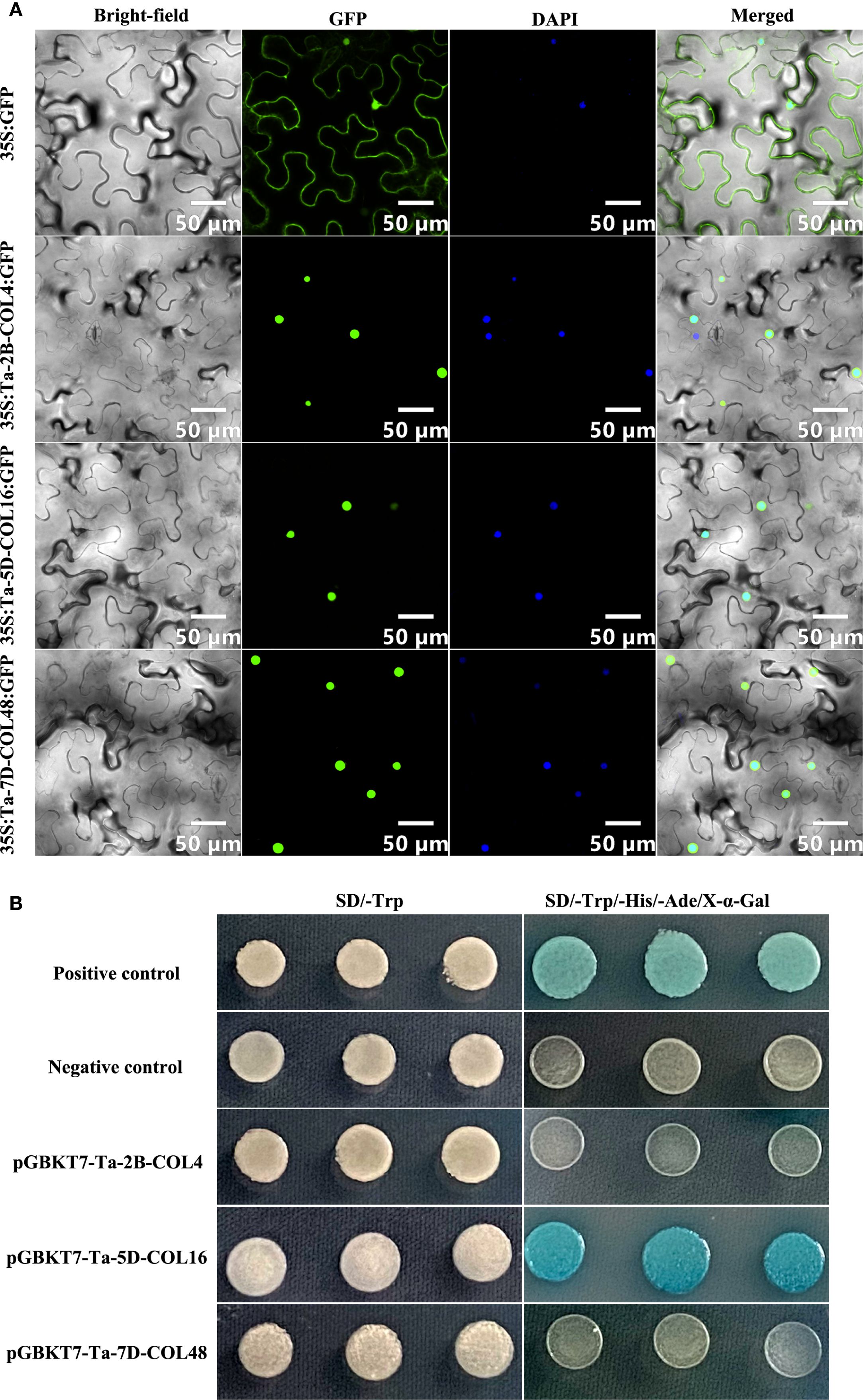 Panel A displays plant cells under different conditions using bright-field, GFP, DAPI, and merged imaging techniques. Each row represents different samples with corresponding green and blue fluorescent markers indicating cell structures. Panel B shows a series of yeast colonies under two conditions: SD/-Trp and SD/-Trp/-His/-Ade/X-α-Gal. Colonies are tested for growth and color changes, with variations between positive control, negative control, and three tested constructs.