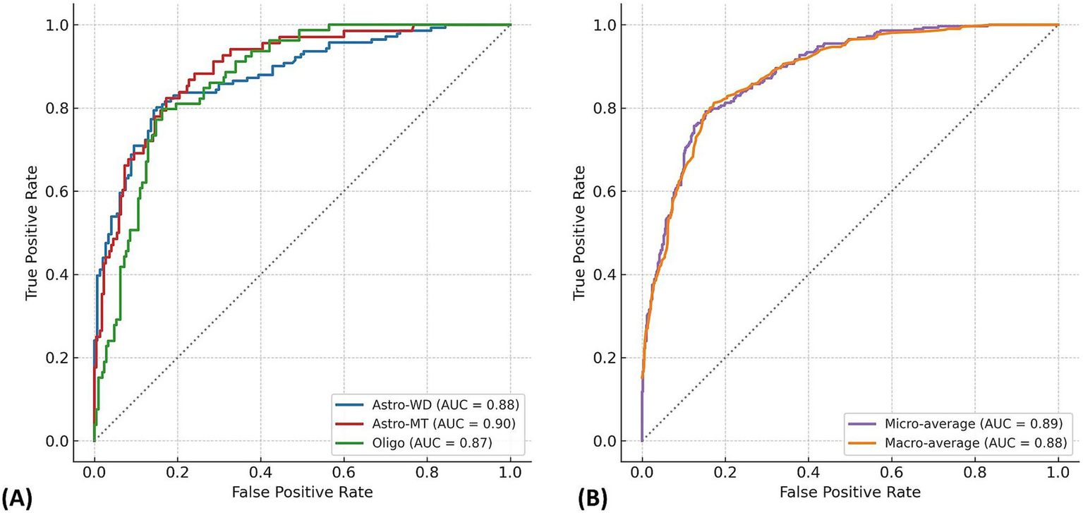 Two ROC curve plots for classification models. Panel A shows three curves: Astro-WD (AUC = 0.88), Astro-MT (AUC = 0.90), and Oligo (AUC = 0.87). Panel B displays micro-average (AUC = 0.89) and macro-average (AUC = 0.88) curves. Both plots have true positive rate (y-axis) versus false positive rate (x-axis).