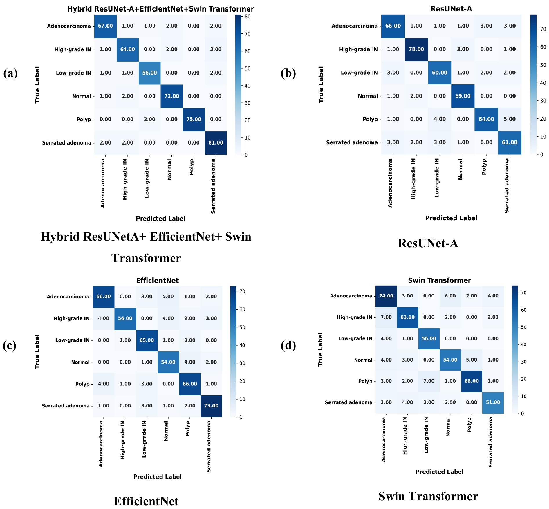 Four heatmaps labeled (a) to (d) compare classifier performance on medical data. Each map has true labels on the y-axis and predicted labels on the x-axis, with color intensity representing accuracy. Panel (a) shows Hybrid ResUNet-A+EfficientNet+Swin Transformer, (b) shows ResUNet-A, (c) shows EfficientNet, and (d) shows Swin Transformer. Each heatmap contains percentages indicating classification accuracy for categories including adenocarcinoma, high-grade IN, low-grade IN, normal, polyp, and serrated adenoma.