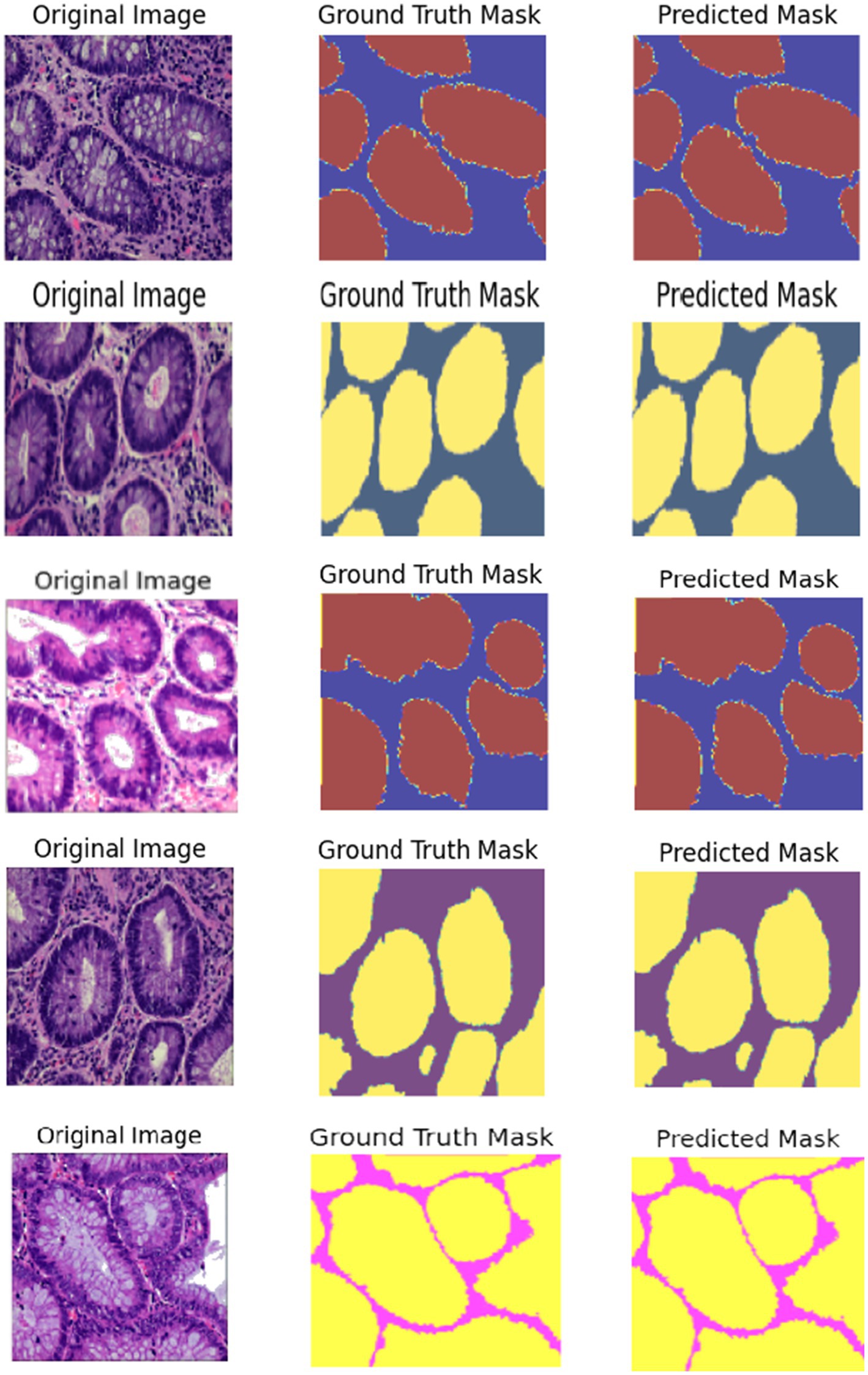 Histology image comparison showing four rows. Each row contains an original histology image, a ground truth mask, and a predicted mask. The masks use distinct colors to highlight different tissue structures for comparison of accuracy between the ground truth and predictions.