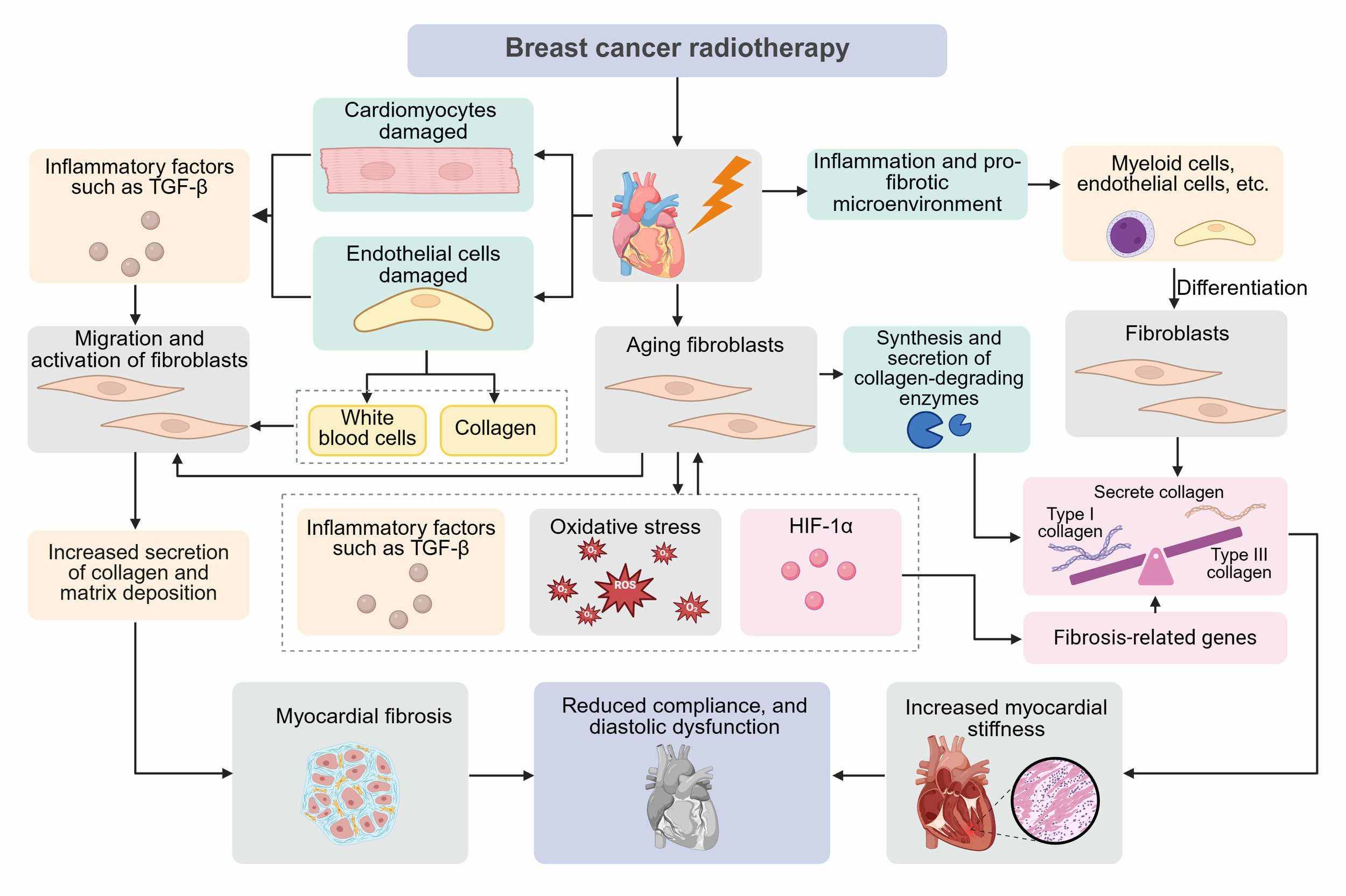 Flowchart illustrating the cellular processes involved in breast cancer radiotherapy leading to myocardial fibrosis. Radiotherapy damages cardiomyocytes and endothelial cells, causing inflammation and fibroblast activation. Fibroblasts age, leading to collagen synthesis and increased matrix deposition. Resultant oxidative stress and activation of HIF-1α promote fibrosis-related genes, causing myocardial fibrosis, reduced compliance, diastolic dysfunction, and increased myocardial stiffness.