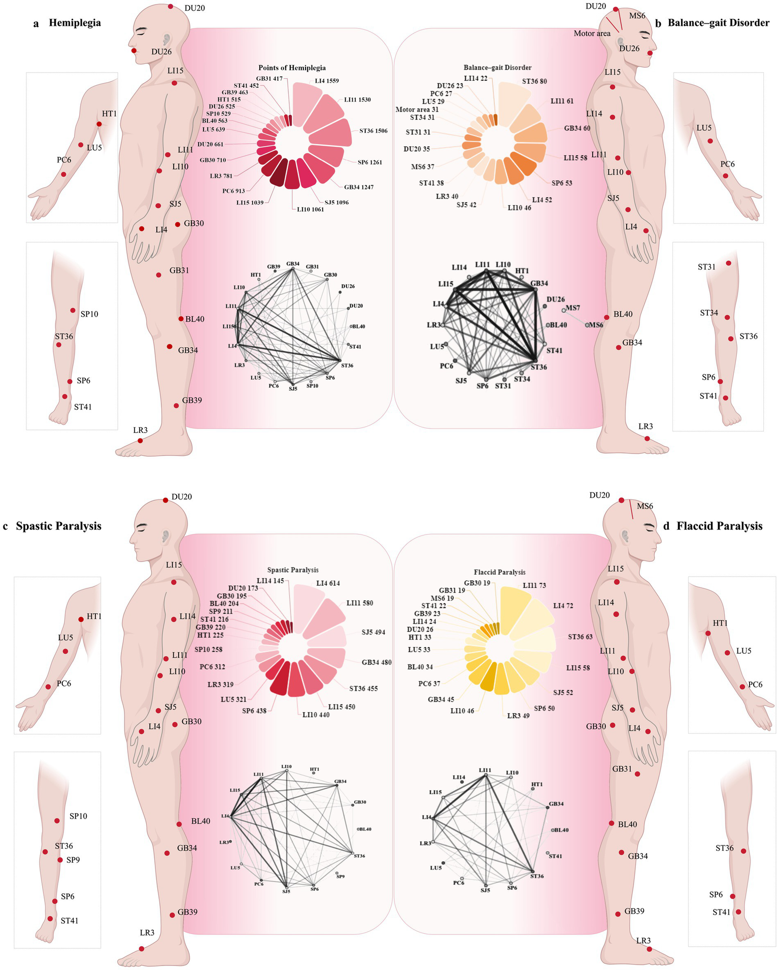 Illustration of four types of paralysis with acupuncture points marked on side views of human bodies. (a) Hemiplegia: acupuncture points on the left side, pie chart, and network diagram. (b) Balance-gait disorder: acupuncture points on the right side with corresponding diagrams. (c) Spastic paralysis: acupuncture points on the left side, pie chart, and network diagram. (d) Flaccid paralysis: acupuncture points on the right side with corresponding diagrams. Each condition's section includes labeled acupuncture points with visual data representations.