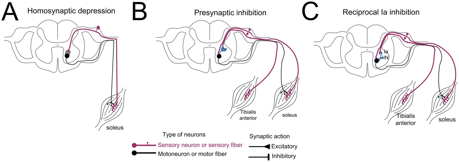 Diagram illustrating three types of neuronal inhibition in the spinal cord. Panel A shows homosynaptic depression with a sensory neuron connected to a motor neuron. Panel B depicts presynaptic inhibition with an additional synapse on the sensory neuron pathway. Panel C presents reciprocal Ia inhibition involving interneurons between sensory and motor neurons. The image includes a key indicating pink lines for sensory neurons and black lines for motoneurons, with arrows for excitatory and inhibitory synaptic actions.