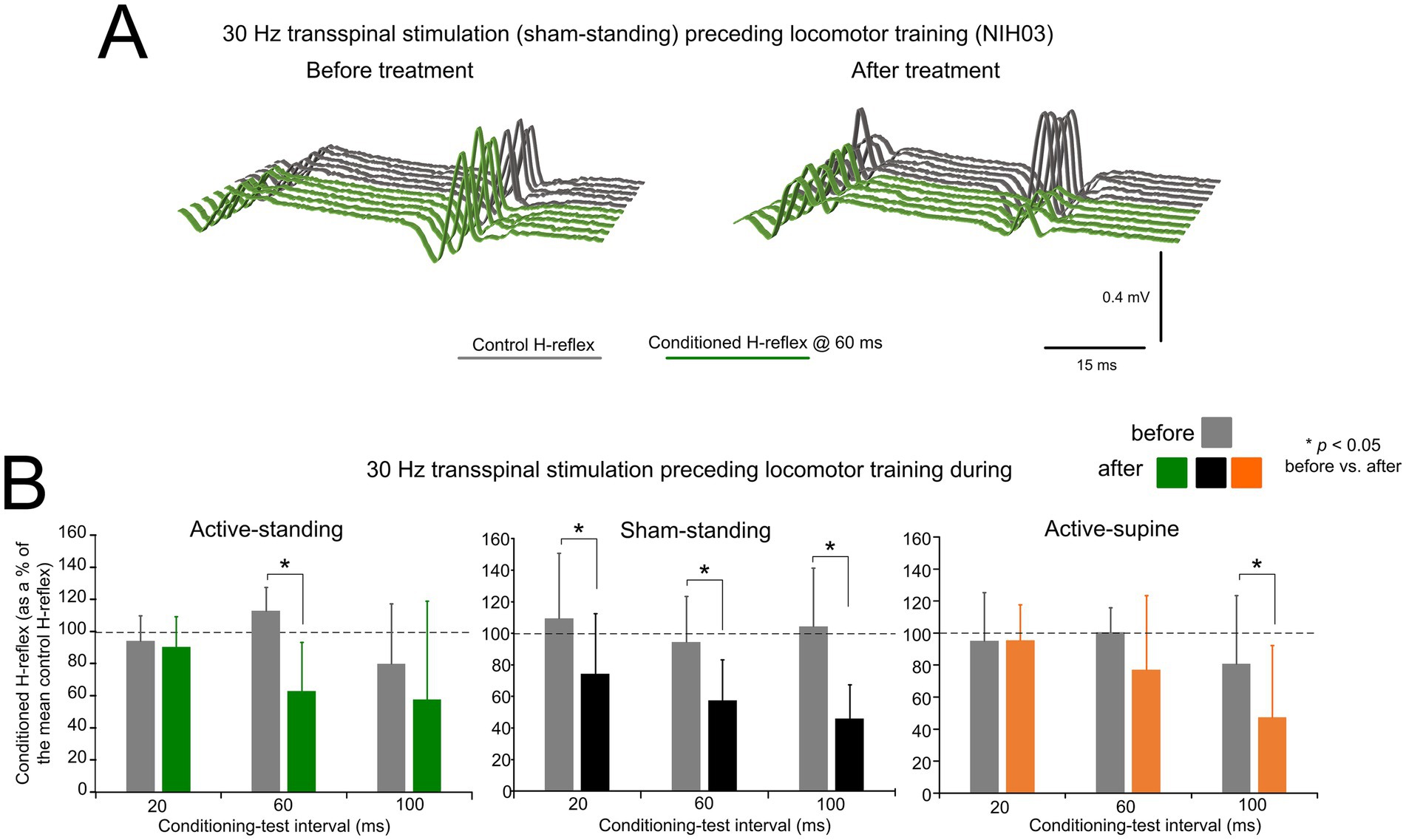Graphs of H-reflex data showing effects of 30 Hz transspinal stimulation. Part A shows waveforms before and after treatment. Part B presents bar graphs comparing conditioned H-reflex percentages at intervals of 20, 60, and 100 milliseconds across active-standing, sham-standing, and active-supine conditions. Significant differences are marked with asterisks for p < 0.05. Colors differentiate pre- and post-treatment measures.