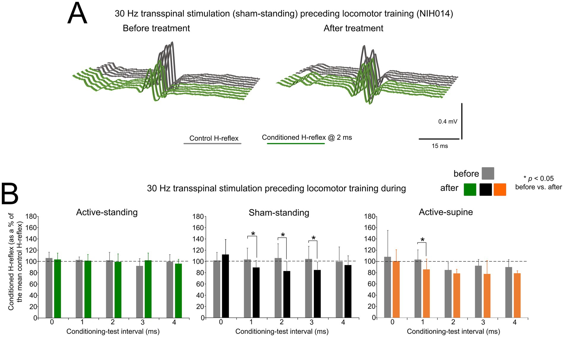 Graphs depicting effects of 30 Hz transspinal stimulation before and after locomotor training. Panel A shows waveforms of control and conditioned H-reflex before and after treatment. Panel B includes bar graphs for active-standing, sham-standing, and active-supine conditions, illustrating conditioned H-reflex percentages at different intervals. Significant differences (p < 0.05) are indicated. Color legend differentiates before (gray) and after (green, black, orange) treatment states.