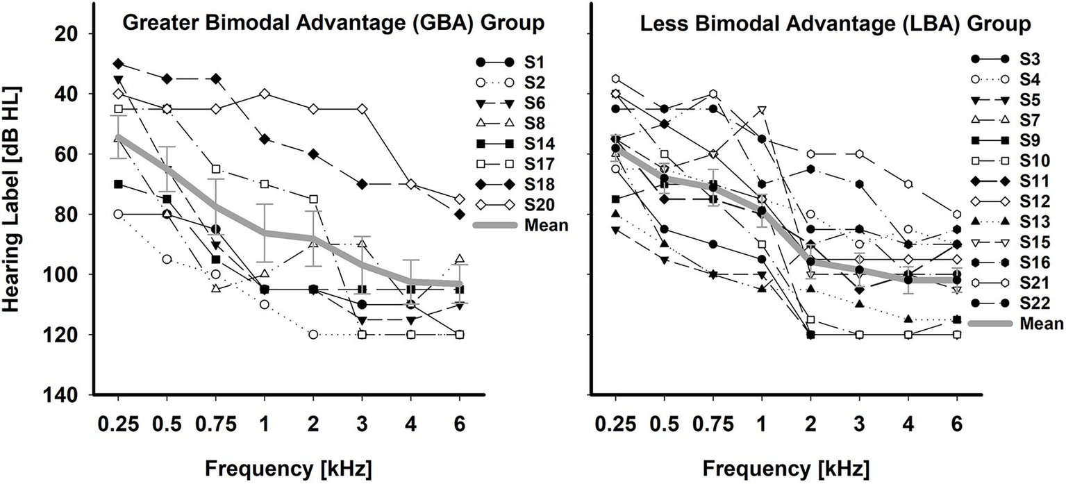 Line graphs compare hearing levels across frequencies for Greater Bimodal Advantage (GBA) and Less Bimodal Advantage (LBA) groups. Both graphs show individual subject data and a mean trend line. The x-axis represents frequency in kilohertz, and the y-axis represents hearing level in decibels. The GBA group tends to have better hearing levels across frequencies compared to the LBA group, as shown by differing mean lines.