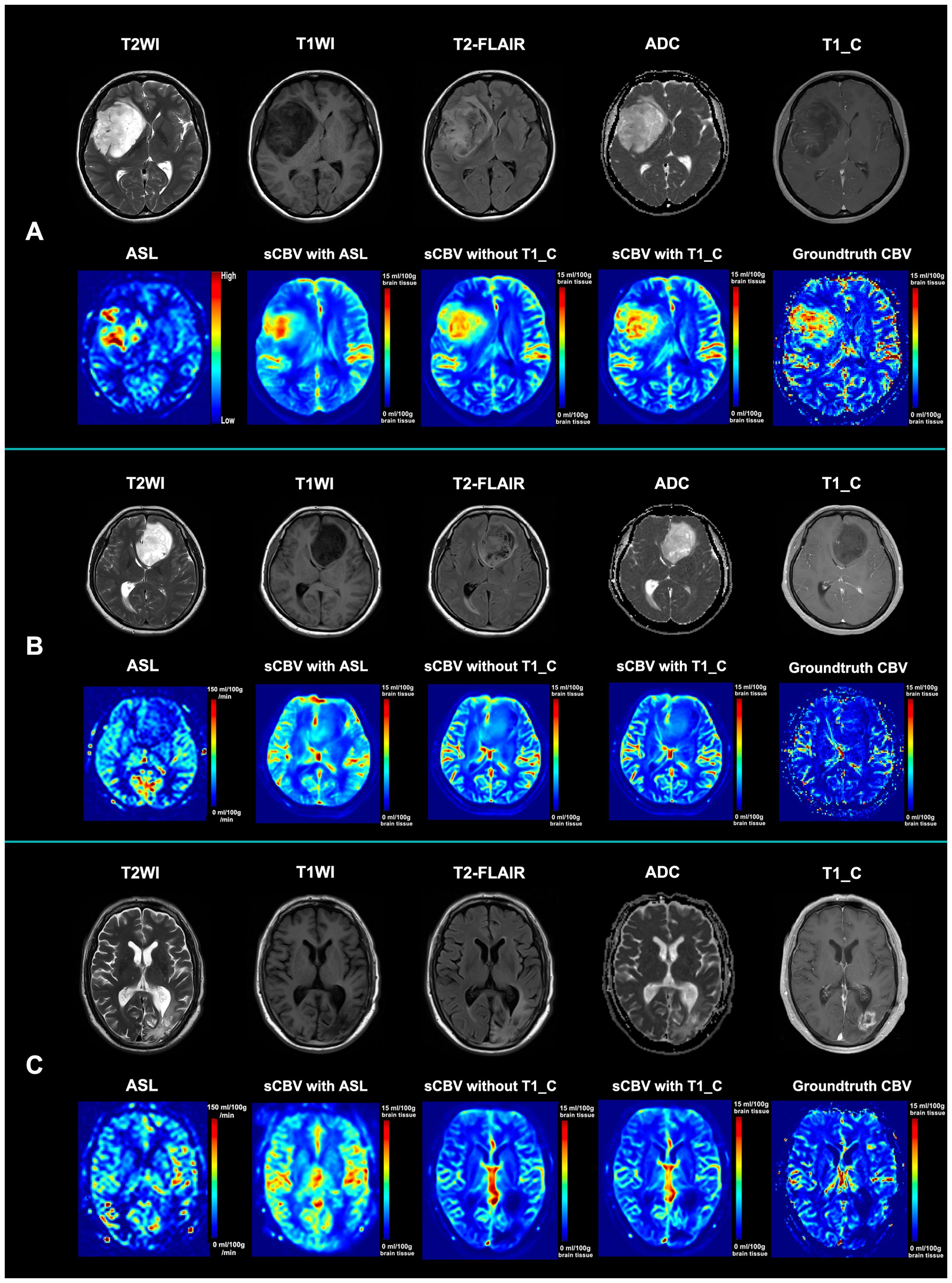 Brain MRI images in three rows labeled A, B, and C. Each row includes T2WI, T1WI, T2-FLAIR, ADC, and T1_C scans. Below, ASL and sCBV images are shown with and without T1_C, plus ground truth CBV images, featuring color scales indicating high to low values.