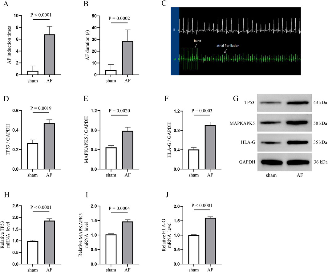Graphs and an electrophysiological recording illustrate differences between sham and atrial fibrillation (AF) groups. Bar graphs A and B show greater AF induction times and duration in AF. Graphs D, E, and F indicate increased TP53, MAPKAPK5, and HLA-G levels in AF. Panel C displays burst activity and atrial fibrillation in a recording. Panel G presents protein expression analysis, with TP53, MAPKAPK5, HLA-G, and GAPDH bands; AF shows higher expression. Bar graphs H, I, and J indicate elevated relative mRNA levels of TP53, MAPKAPK5, and HLA-G in AF. Significant differences are marked by p-values.