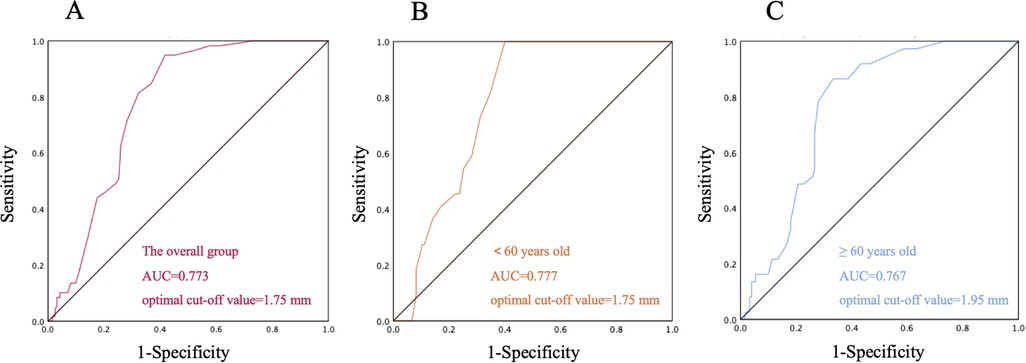 Three ROC curves labeled A, B, and C show sensitivity versus 1-specificity. A: Overall group, AUC 0.773, optimal cut-off 1.75 mm. B: Under 60 years, AUC 0.777, cut-off 1.75 mm. C: Over 60 years, AUC 0.767, cut-off 1.95 mm.