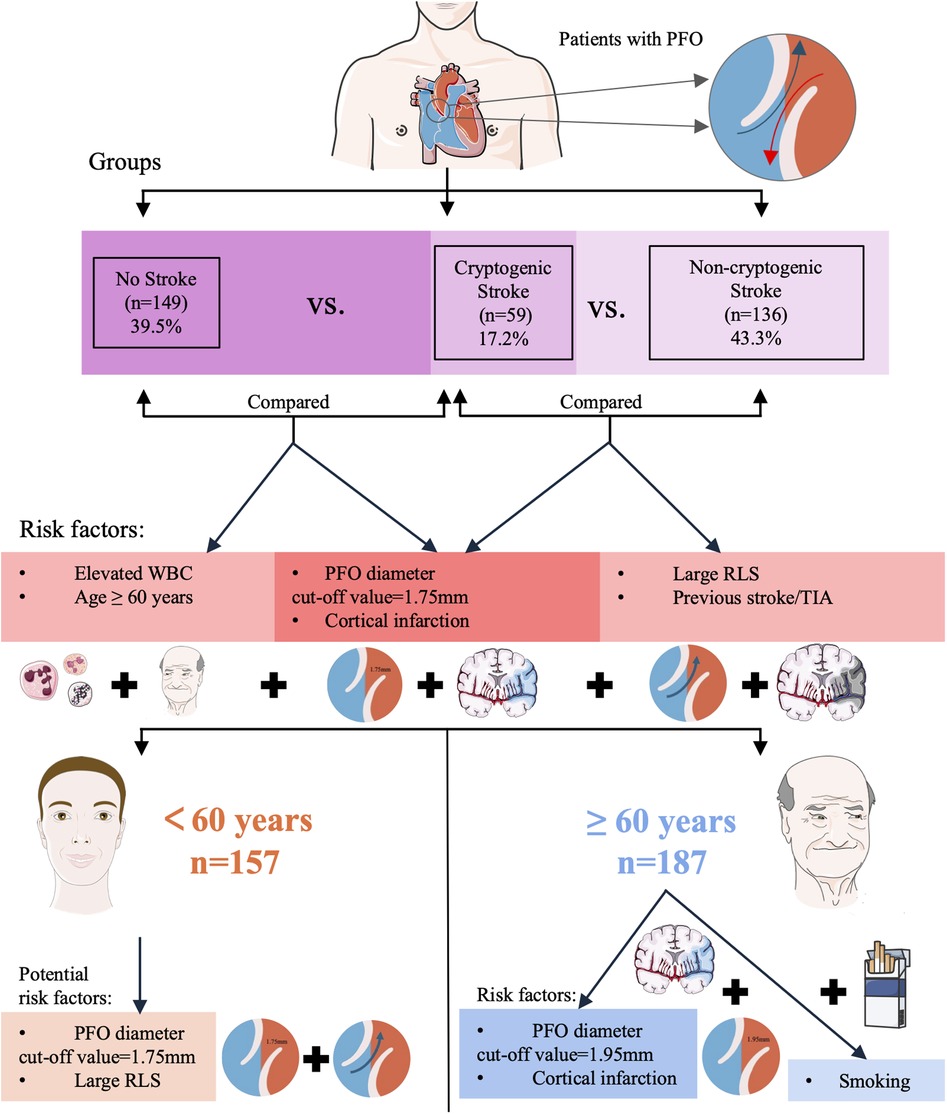 Diagram showing the breakdown of patients with Patent Foramen Ovale (PFO) into three groups: No Stroke (39.5%), Cryptogenic Stroke (17.2%), and Non-cryptogenic Stroke (43.3%). It presents risk factors: elevated white blood cell count, age over 60, PFO diameter, cortical infarction, large right-to-left shunt, previous stroke, and smoking. It further categorizes patients under and over 60, highlighting specific risk factors. Arrows, icons, and text illustrate relationships and details for each category.