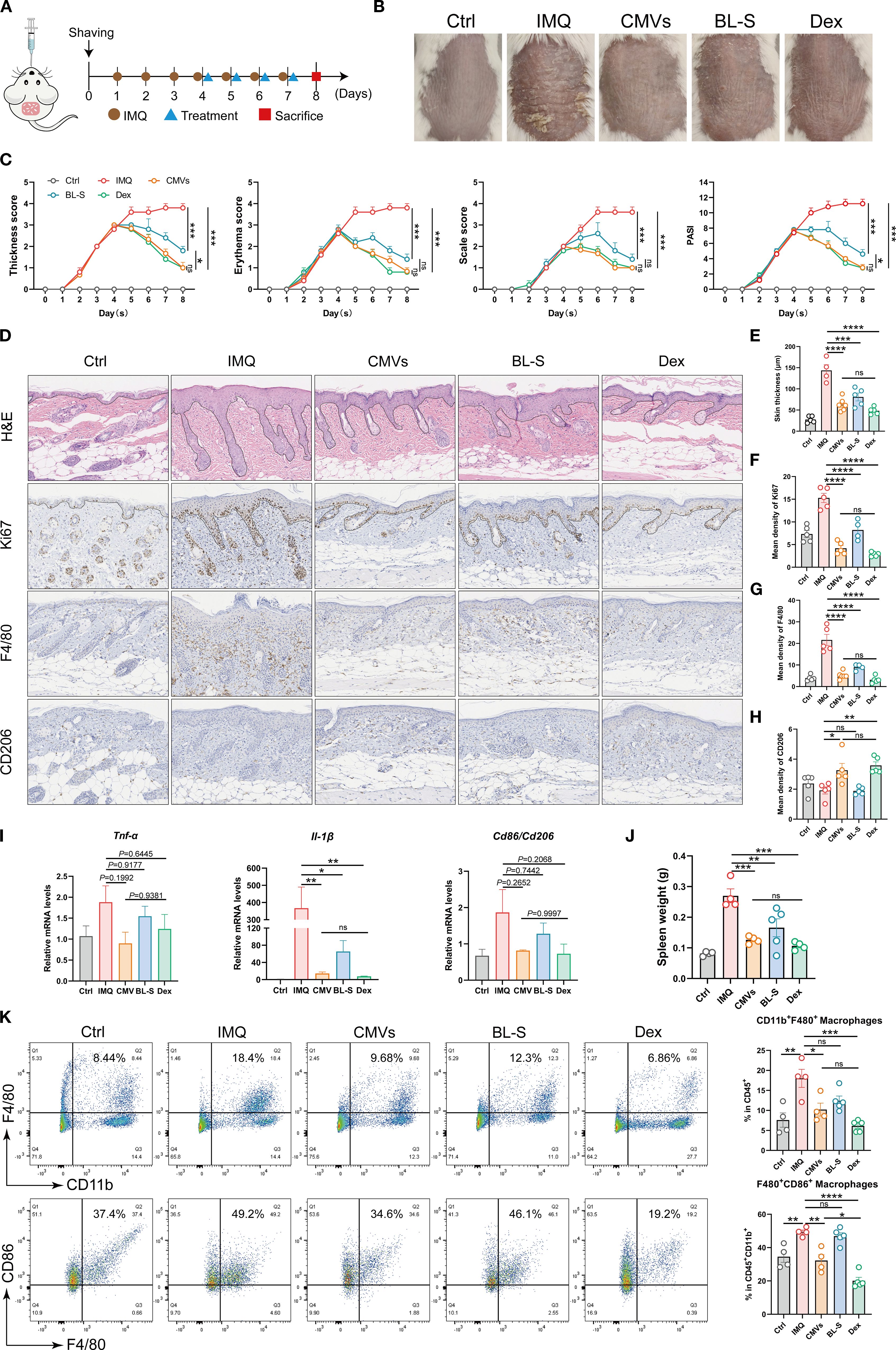 This figure evaluates CMVs' therapeutic efficacy in an IMQ-induced murine psoriasis model. Panel A shows the experimental timeline. Panel B presents dorsal skin images. Panel C quantifies skin thickness, erythema, scaling, and PASI scores. Panels D-H display histological and immunohistochemical analyses of epidermal hyperplasia and macrophage infiltration. Panel I shows inflammatory mRNA expression. Panel J compares spleen weights. Panel K presents flow cytometry analysis of splenic macrophages. Results demonstrate oral CMVs significantly alleviate psoriatic symptoms, reduce epidermal hyperplasia and macrophage infiltration, decrease splenomegaly, and modulate macrophage polarization, achieving efficacy comparable to dexamethasone.