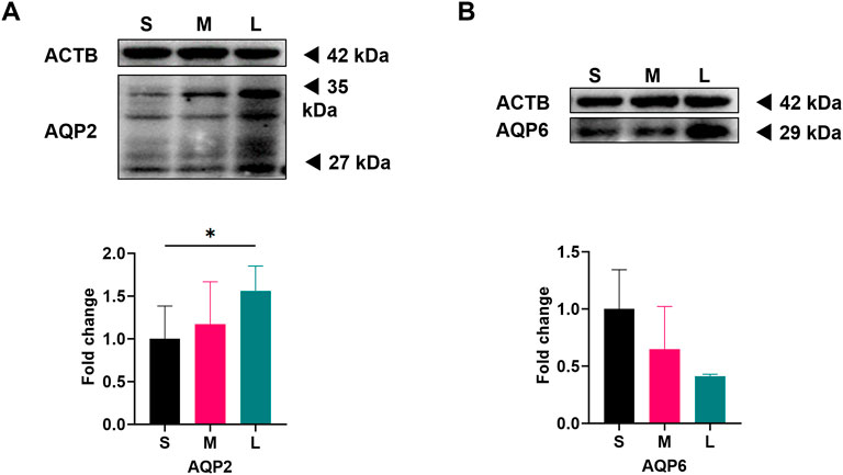 Western blot analysis and bar graphs comparing AQP2 and AQP6 protein levels in samples labeled S, M, and L, with ACTB as a loading control. AQP2 shows increased expression in larger samples, while AQP6 expression decreases. Molecular weights are indicated beside the blots.