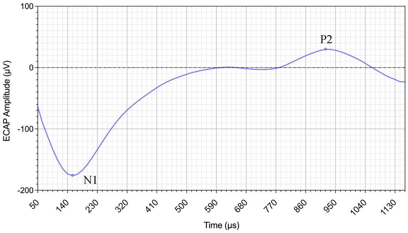 Graph showing ECAP amplitude in microvolts over time in microseconds. The curve starts with a dip at N1, around 140 microseconds and -160 microvolts, and peaks at P2, around 860 microseconds and 65 microvolts. Grid lines provide reference points.