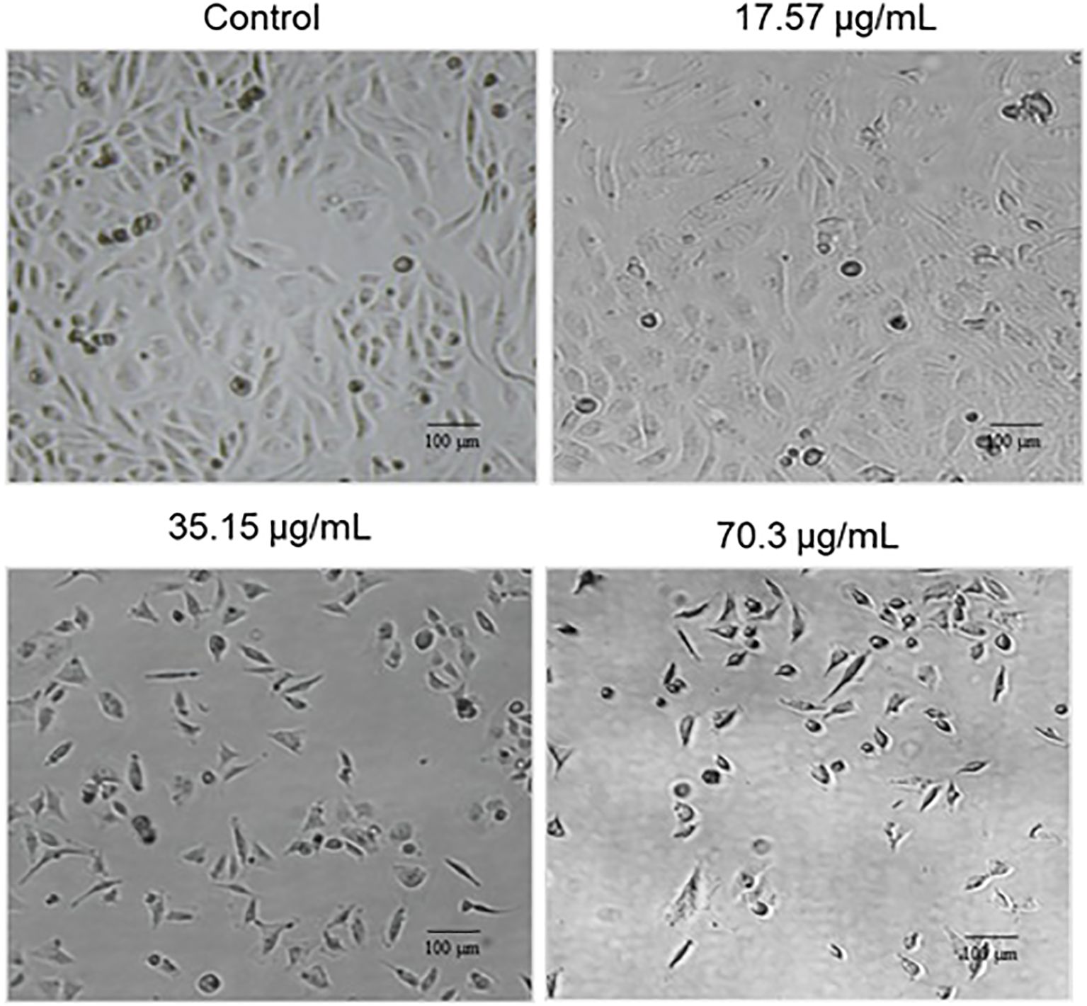 Four images show cell cultures under different conditions. The control image displays dense cells. At 17.57 micrograms per milliliter, there are fewer cells. At 35.15 micrograms per milliliter, cell density decreases noticeably. At 70.3 micrograms per milliliter, cells are sparse and irregularly shaped. Each image includes a 100 micrometer scale bar.