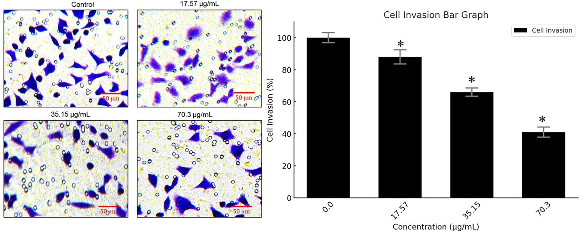 Microscopy images show cell invasion at varying concentrations: Control, 17.57 µg/mL, 35.15 µg/mL, and 70.3 µg/mL. A bar graph shows decreasing cell invasion percentage corresponding to increasing concentrations, with statistical significance indicated by asterisks.