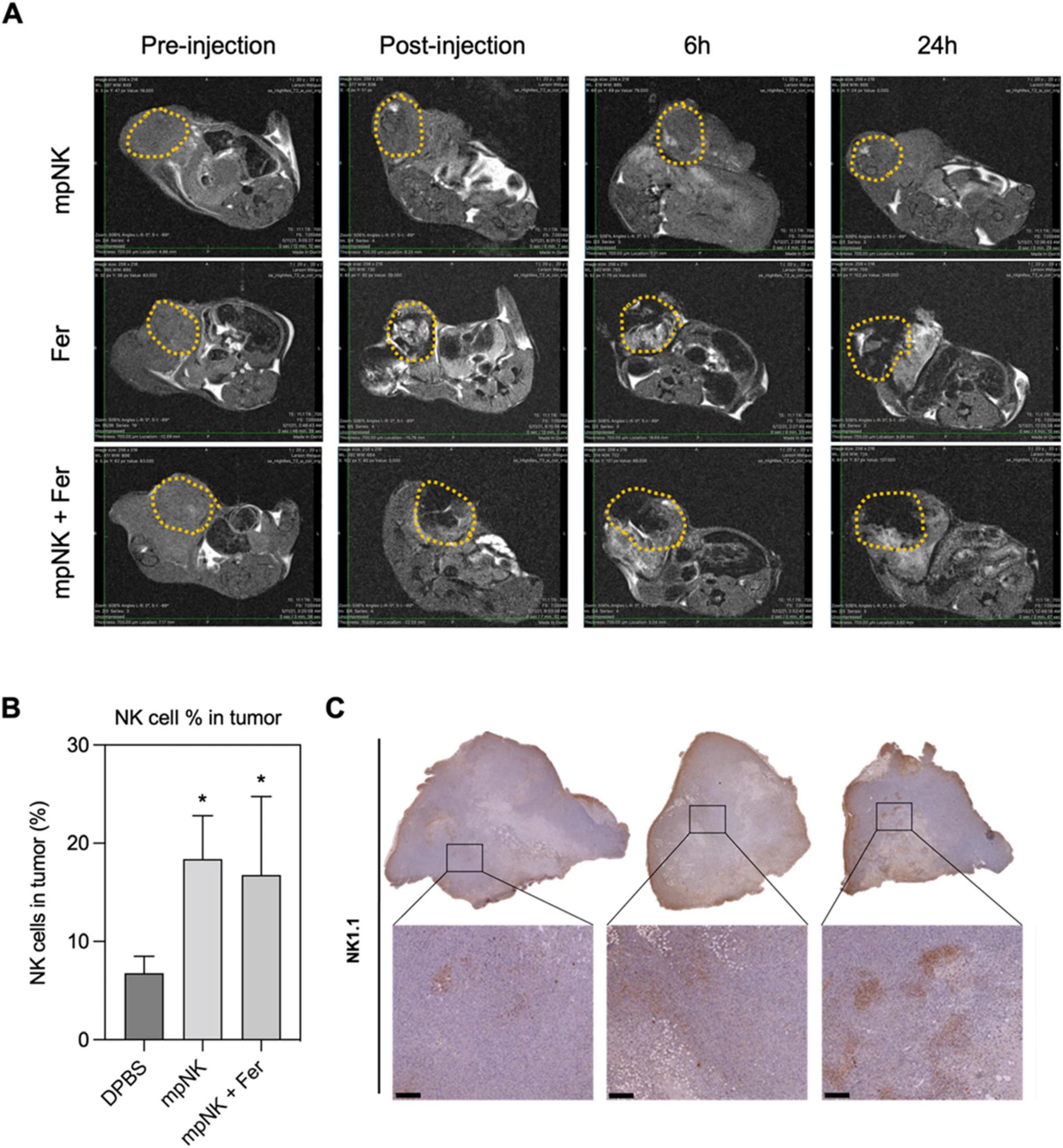 A: MRI images showing tumor regions outlined, with columns for different time points (Pre-injection, Post-injection, 6 hours, 24 hours) and rows for treatments (mpNK, Fer, mpNK + Fer). B: Bar graph showing percentage of NK cells in tumors for DPBS, mpNK, and mpNK + Fer, with mpNK and mpNK + Fer showing higher percentages. C: Three tissue samples stained for NK1.1, each with a focused inset showing detailed cell distribution.