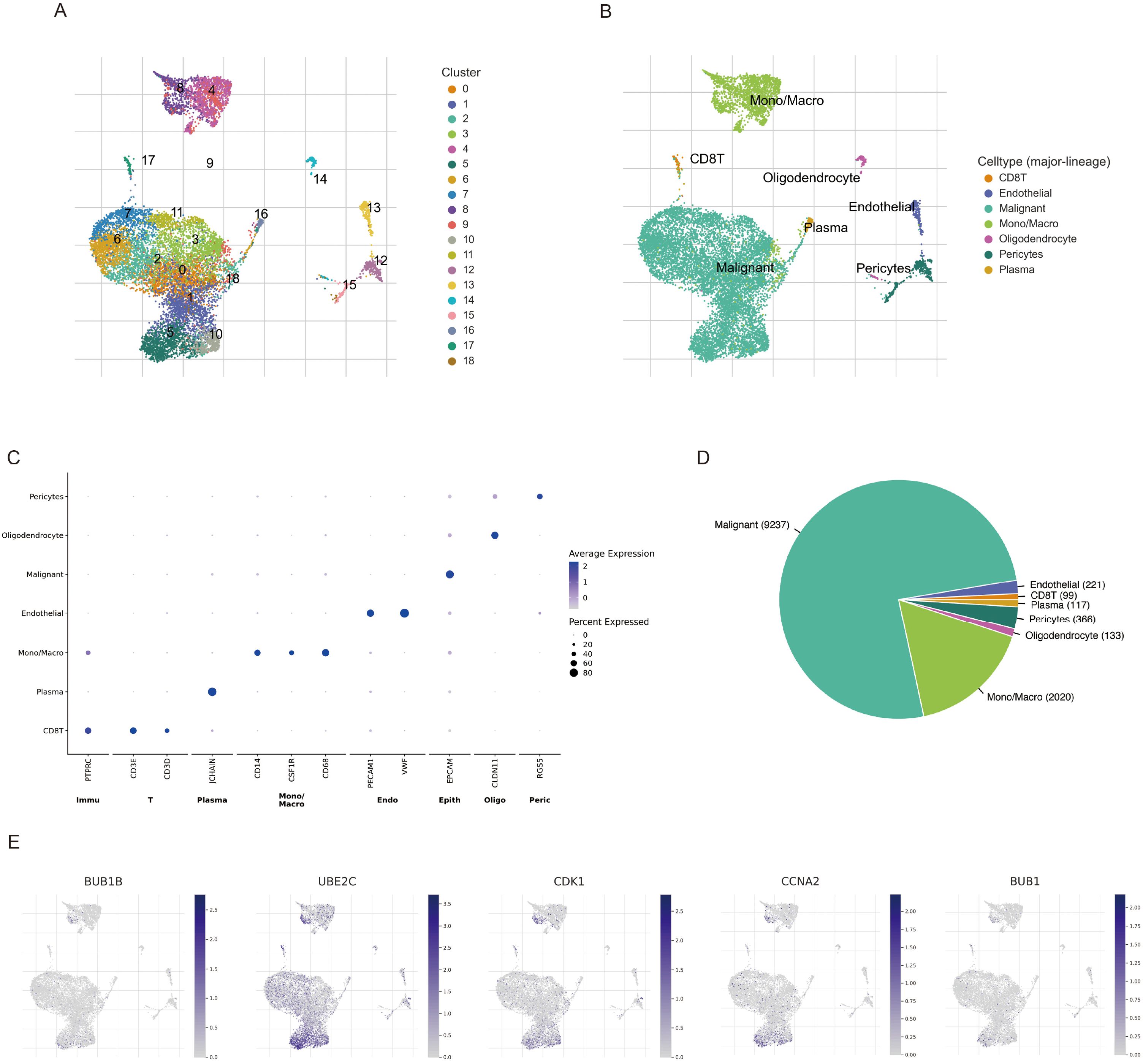 Composite image with five components: A) Scatter plot showing clusters of data points labeled 0 to 18 in various colors. B) Scatter plot with data classified into cell types like Malignant, Mono/Macro, and others. C) Dot plot showing average expression against cell types with dot size indicating percent expressed. D) Pie chart displaying proportions of different cell types, with Malignant and Mono/Macro having the largest segments. E) Series of expression plots for genes BUB1B, UBE2C, CDK1, CCNA2, and BUB1, highlighting specific areas of expression across the plotted data.