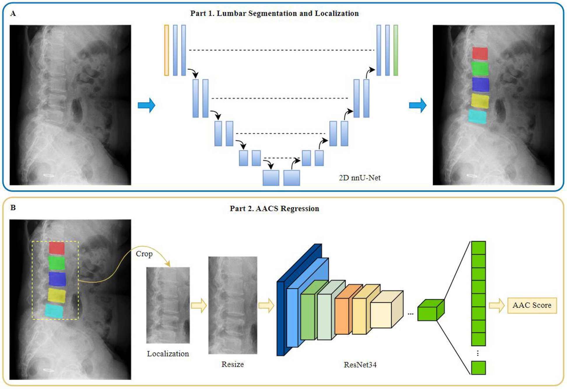 Diagram illustrating a two-part process for lumbar spine analysis. Part 1 involves cropping, resizing, and processing of spinal images, showing lumbar segmentation and localization using 2D nnU-Net with colored rectangular overlays on X-rays. Part 2 involves AACS regression, depicting the processing of the segmented images through a ResNet34 model to derive an AAC score.